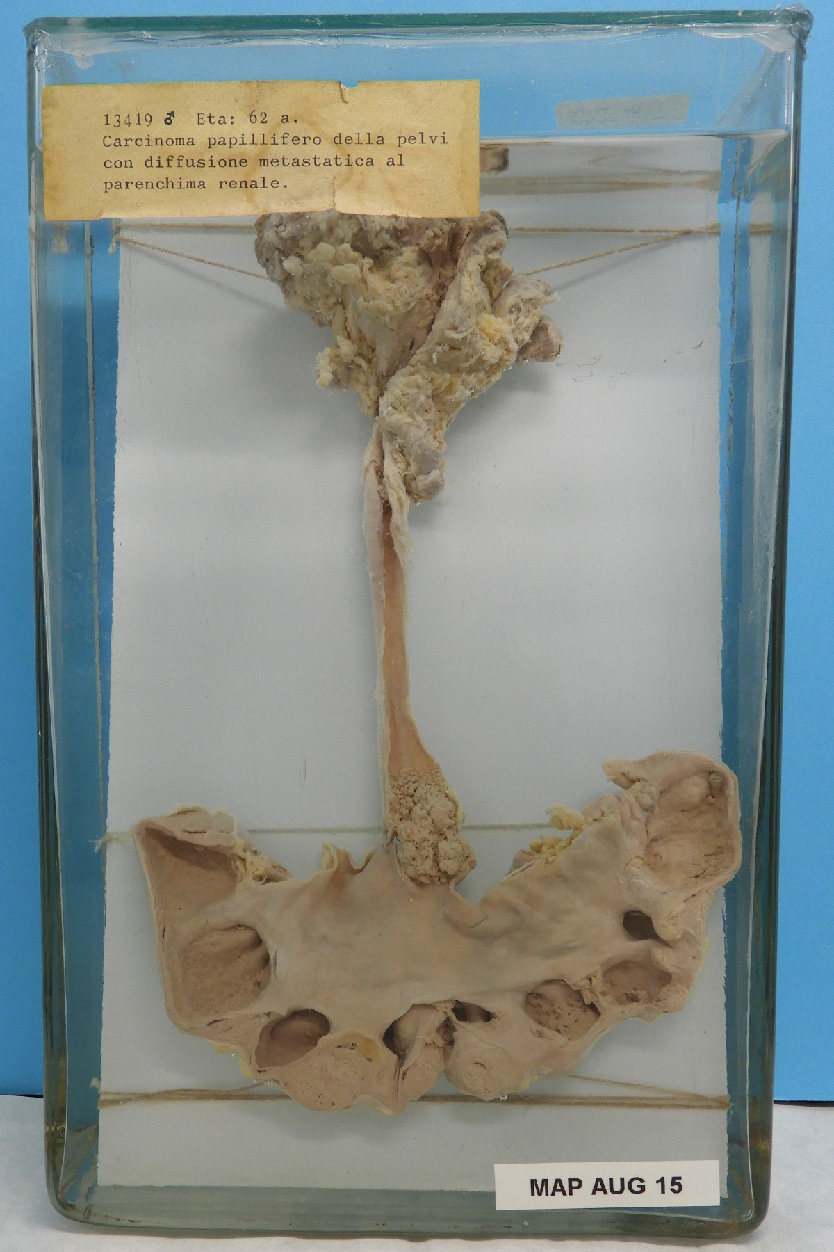 preparato anatomico, apparato urogenitale (morfologia naturale) (SECOLI/ XX)