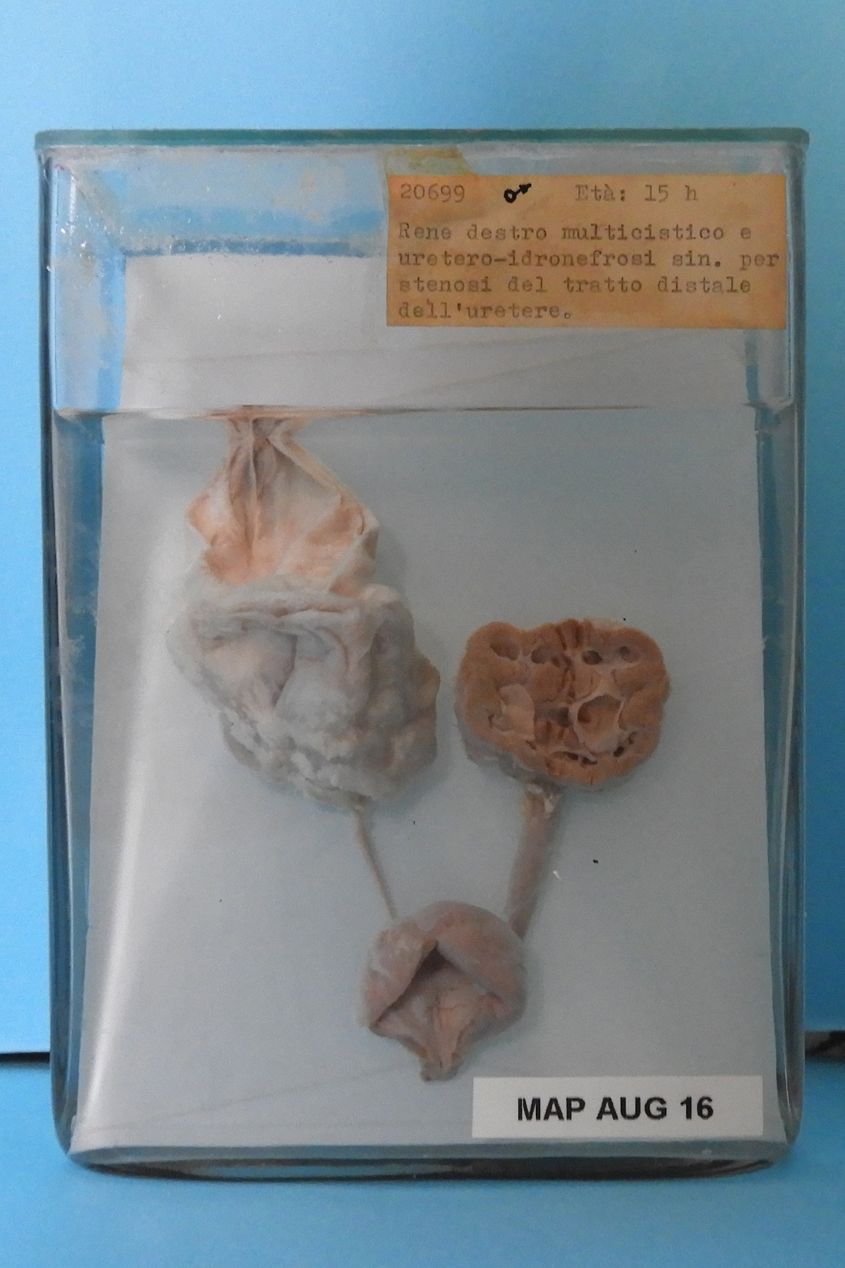 preparato anatomico, apparato urogenitale (morfologia naturale) (SECOLI/ XX)