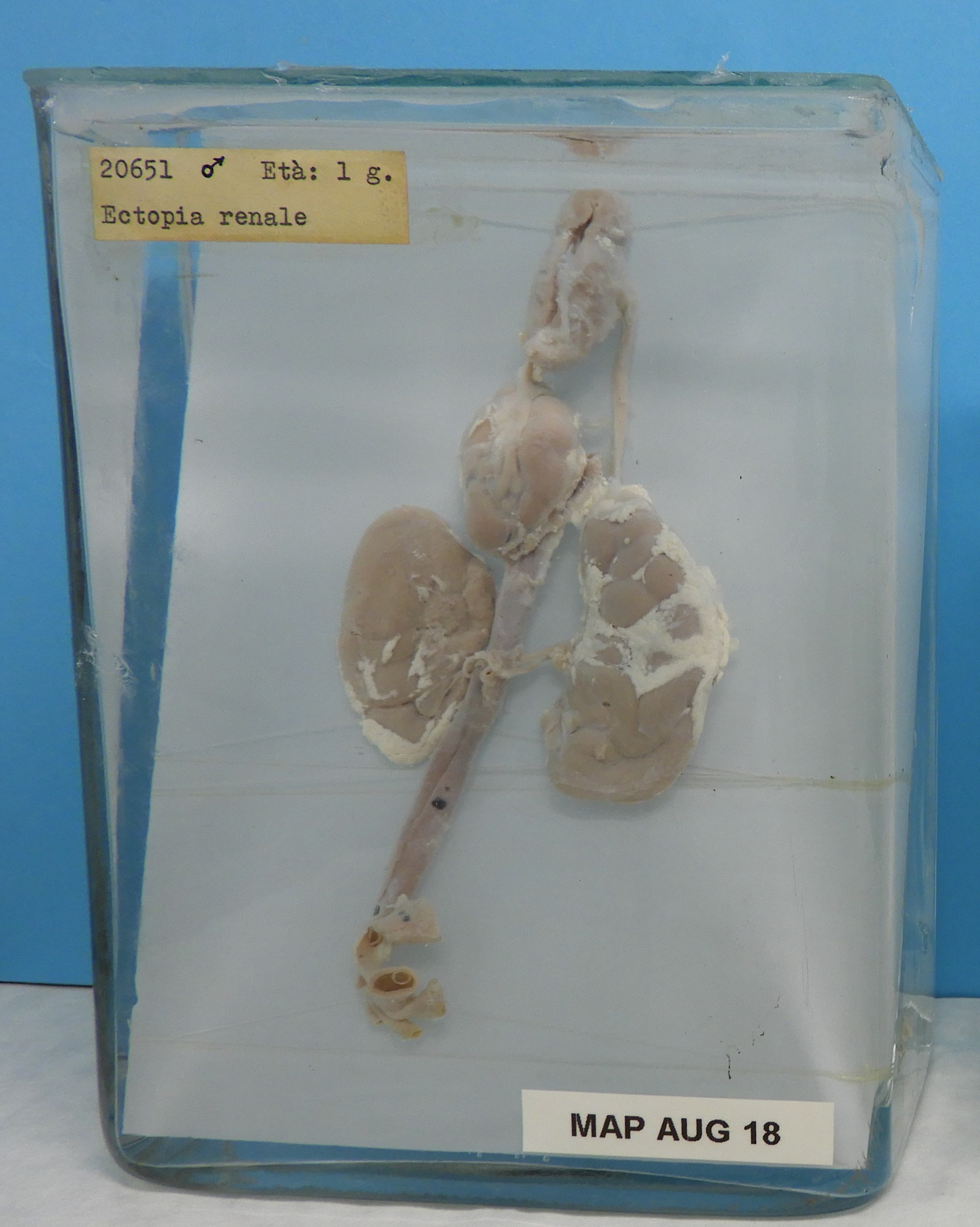 preparato anatomico, apparato urogenitale (morfologia naturale) (SECOLI/ XX)