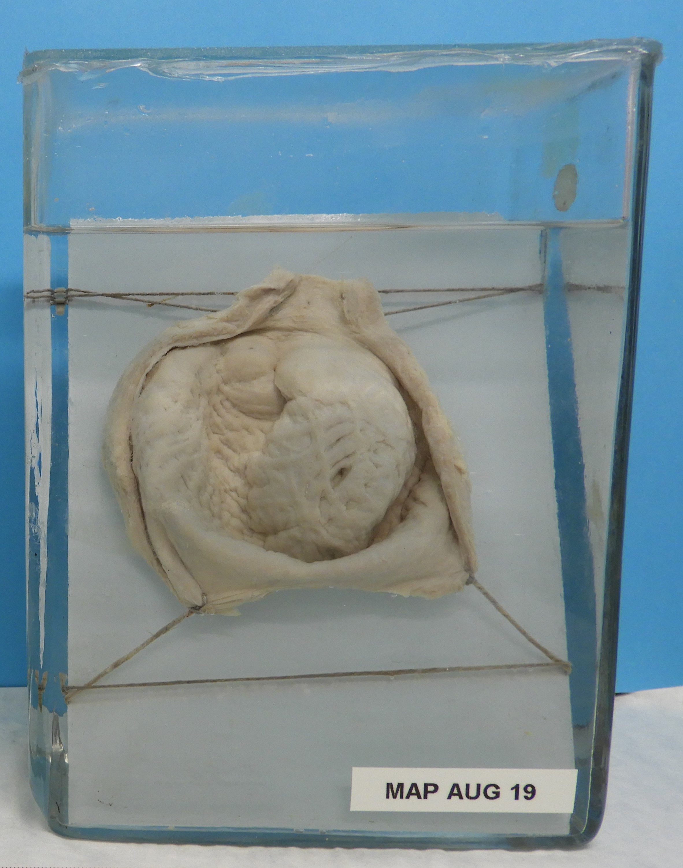 preparato anatomico, apparato urogenitale (morfologia naturale) (SECOLI/ XX)