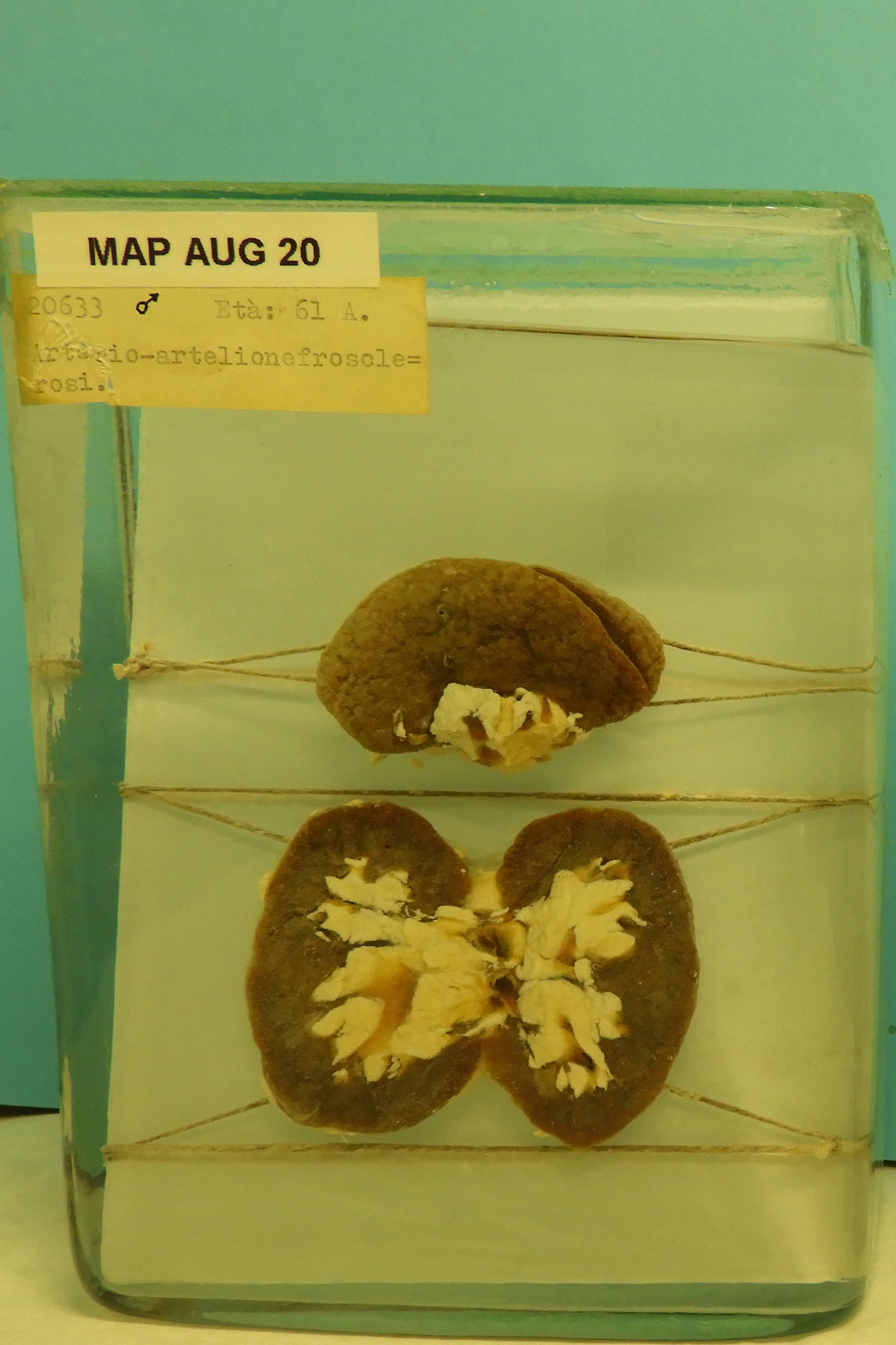 preparato anatomico, apparato urogenitale (morfologia naturale) (SECOLI/ XX)