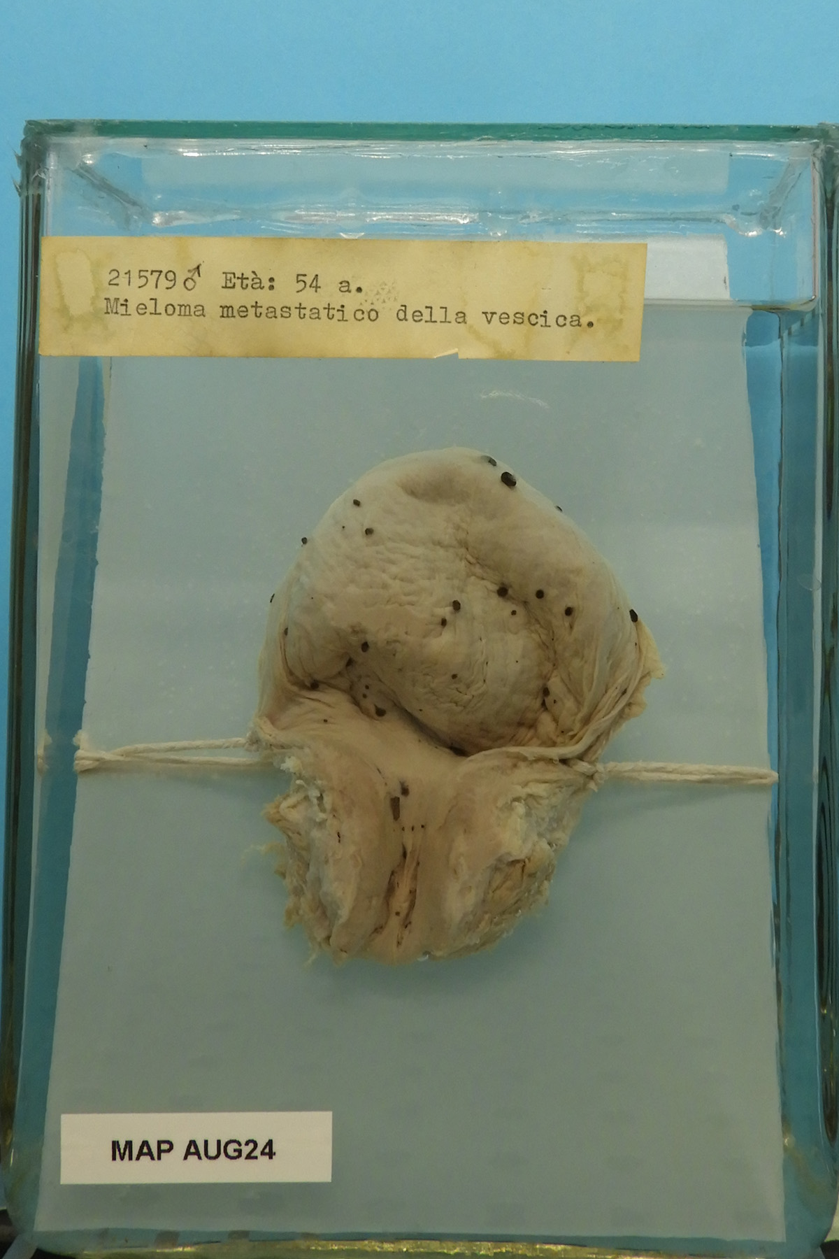 preparato anatomico, apparato urogenitale (morfologia naturale) (SECOLI/ XX)