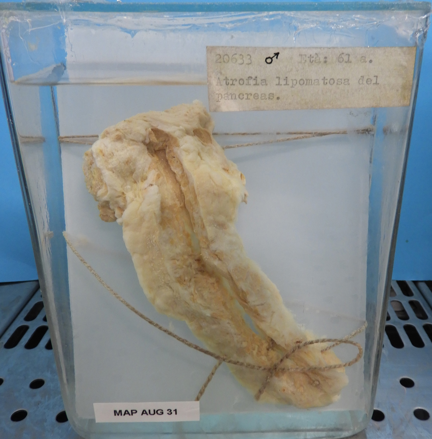 preparato anatomico, apparato urogenitale (morfologia naturale) (SECOLI/ XX)