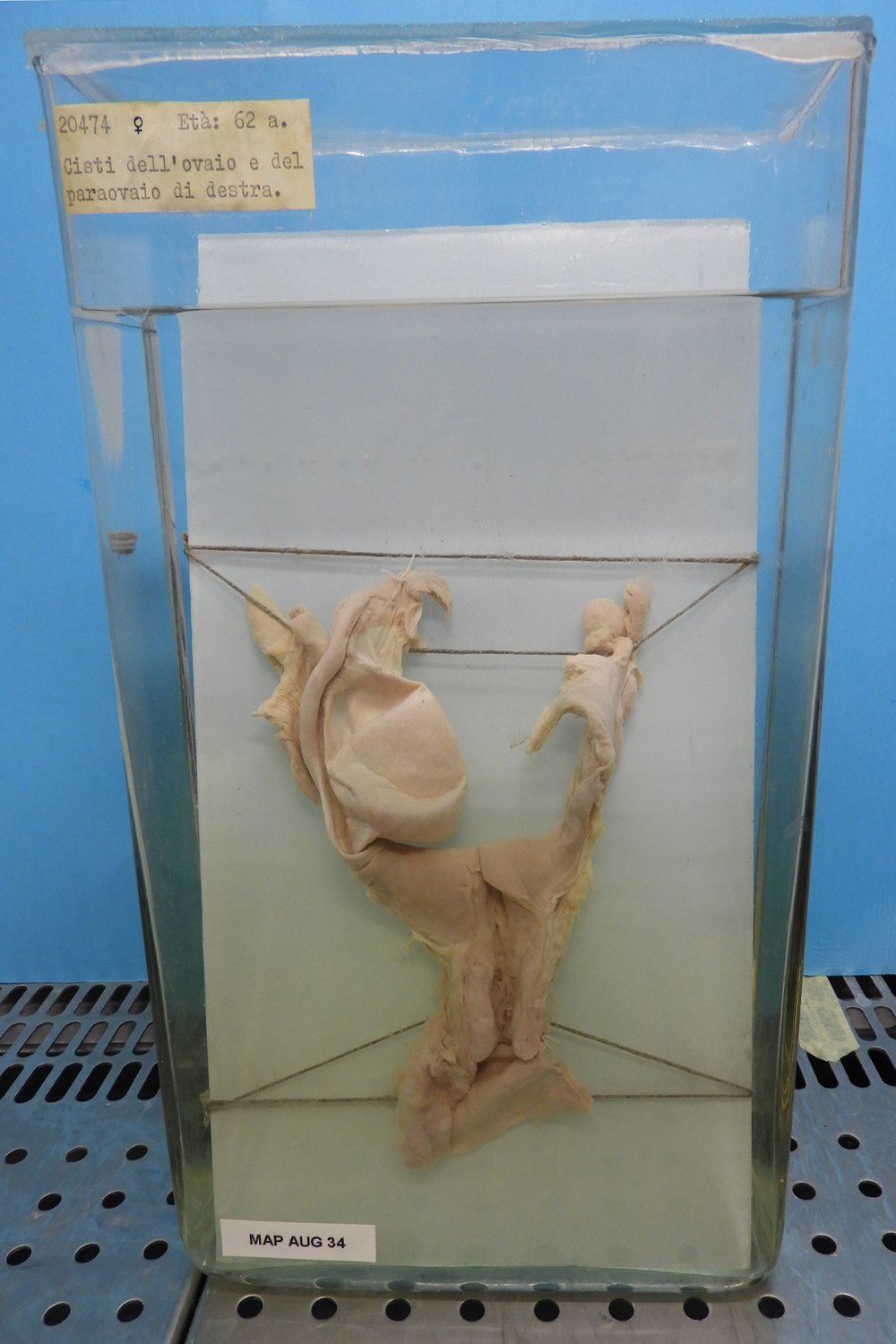 preparato anatomico, apparato urogenitale (morfologia naturale) (SECOLI/ XX)