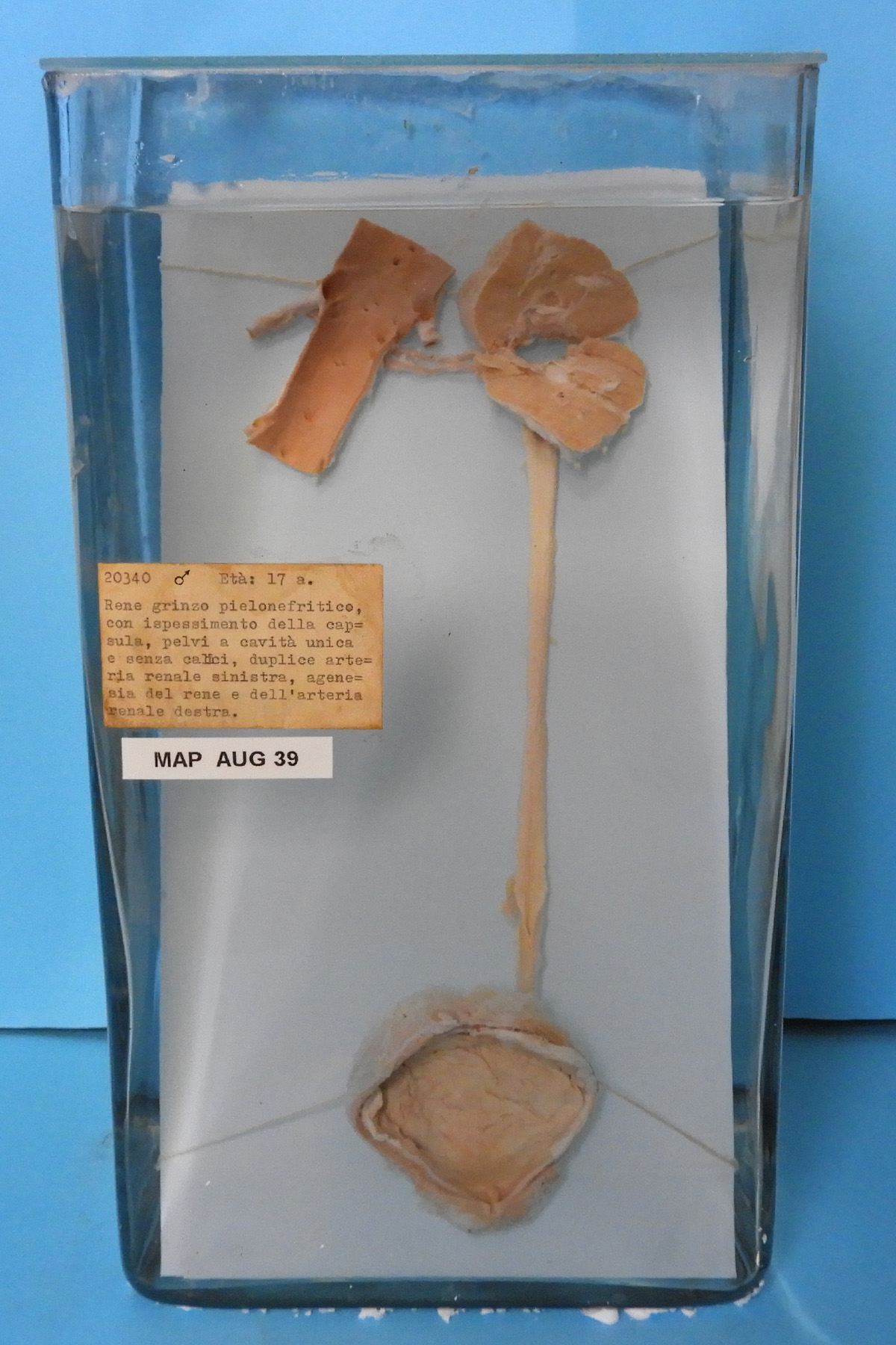 preparato anatomico, apparato urogenitale (morfologia naturale) (SECOLI/ XX)