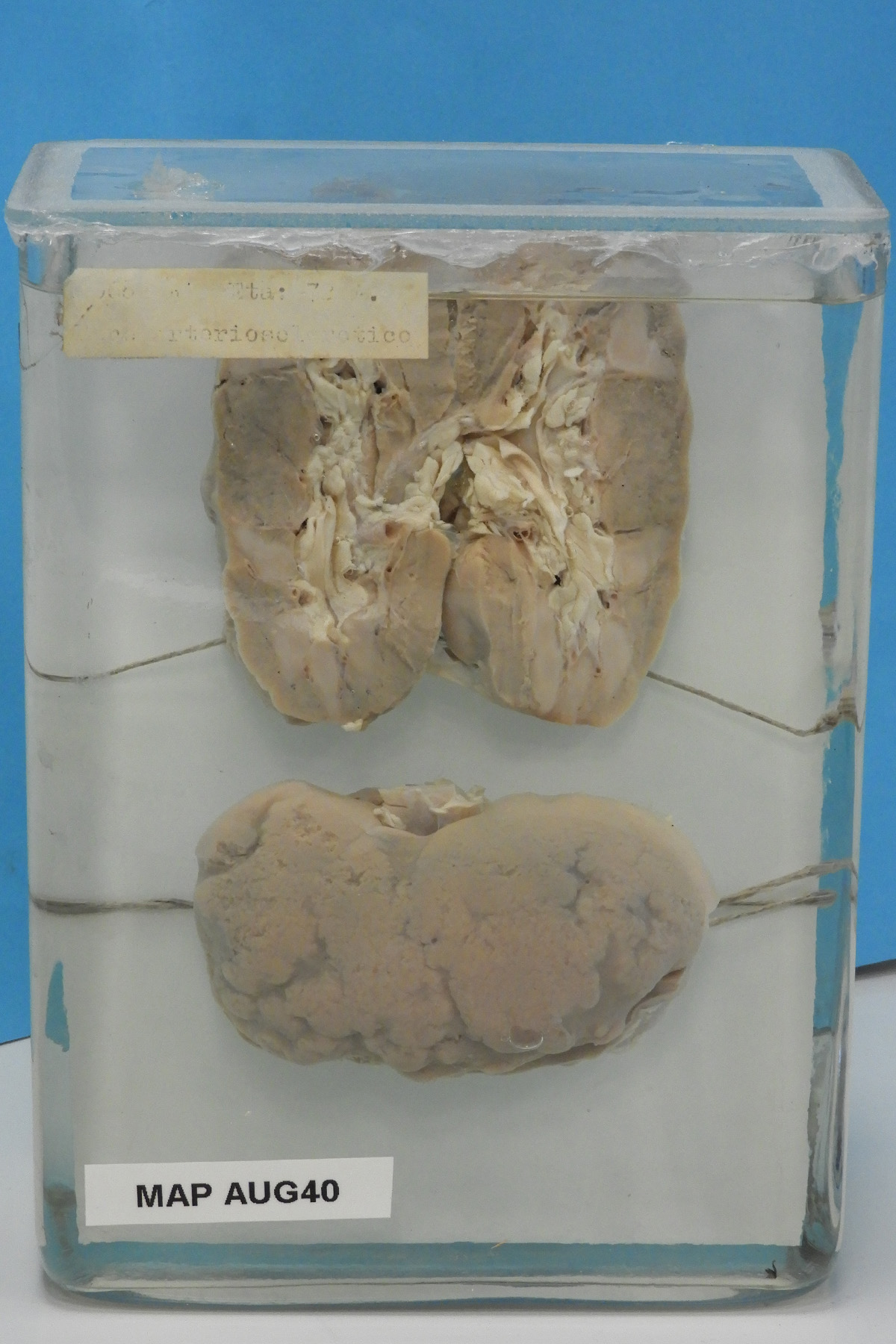 preparato anatomico, apparato urogenitale (morfologia naturale) (SECOLI/ XX)