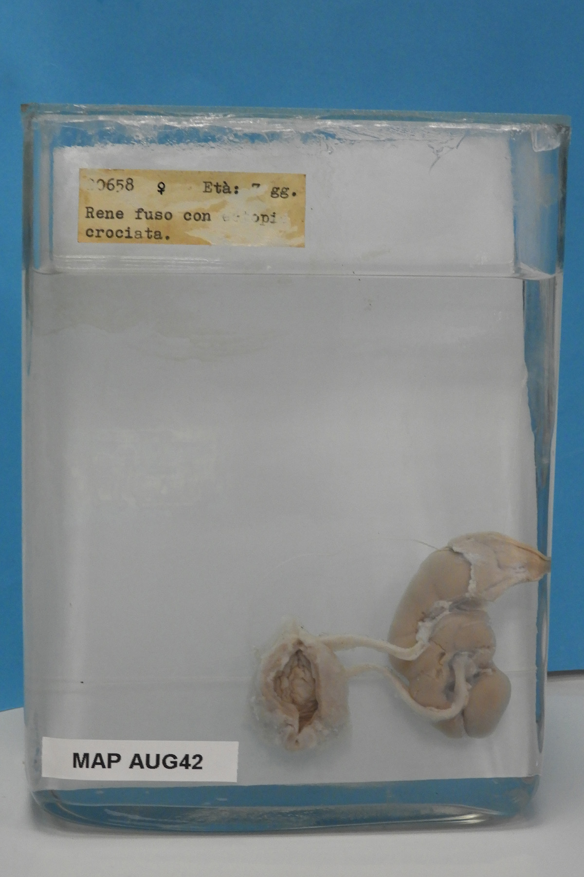 preparato anatomico, apparato urogenitale (morfologia naturale) (SECOLI/ XX)