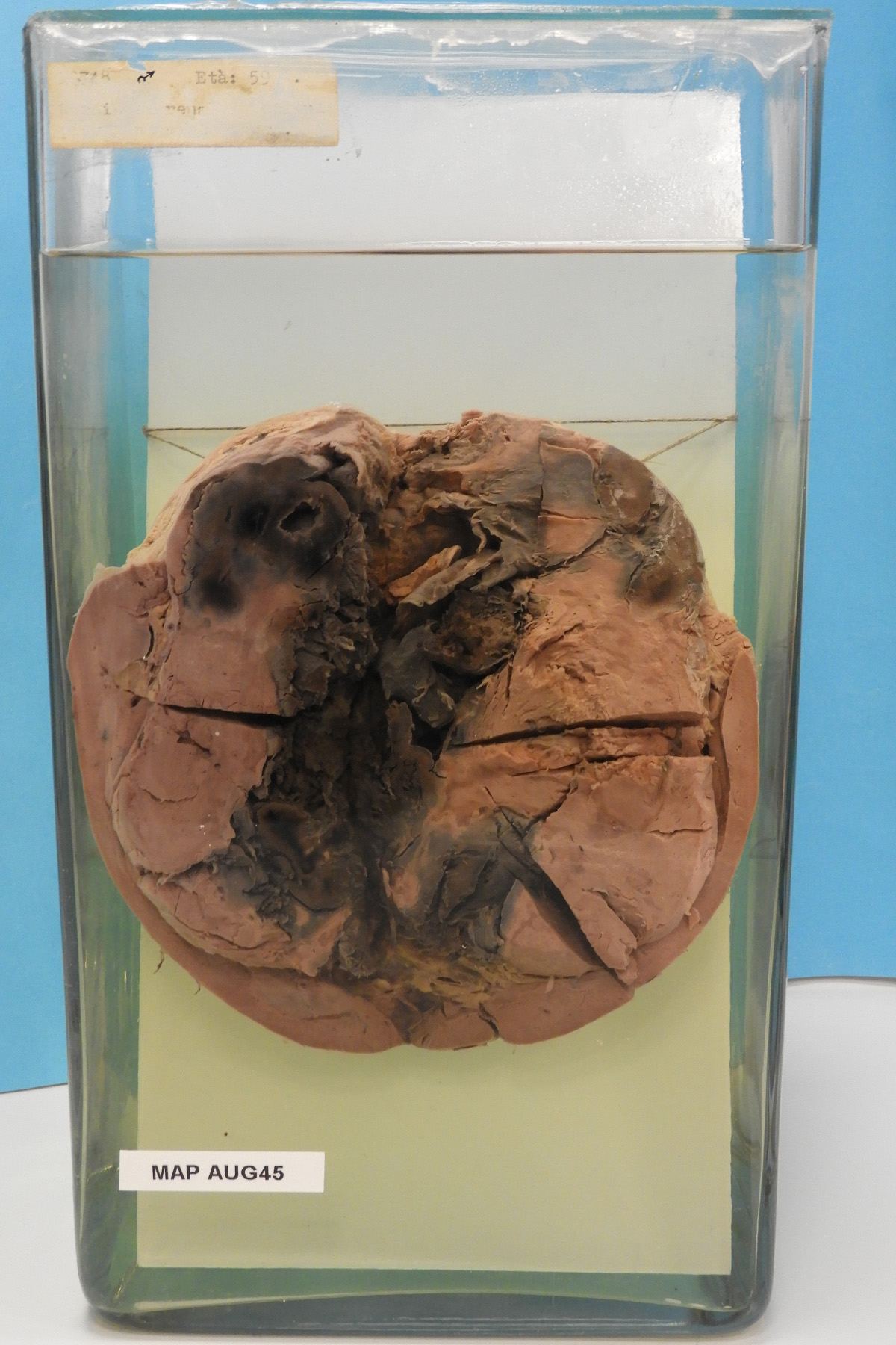 preparato anatomico, apparato urogenitale (morfologia naturale) (SECOLI/ XX)