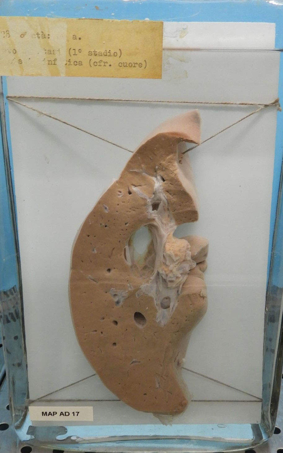 preparato anatomico, apparato digerente (morfologia naturale) (SECOLI/ XX)