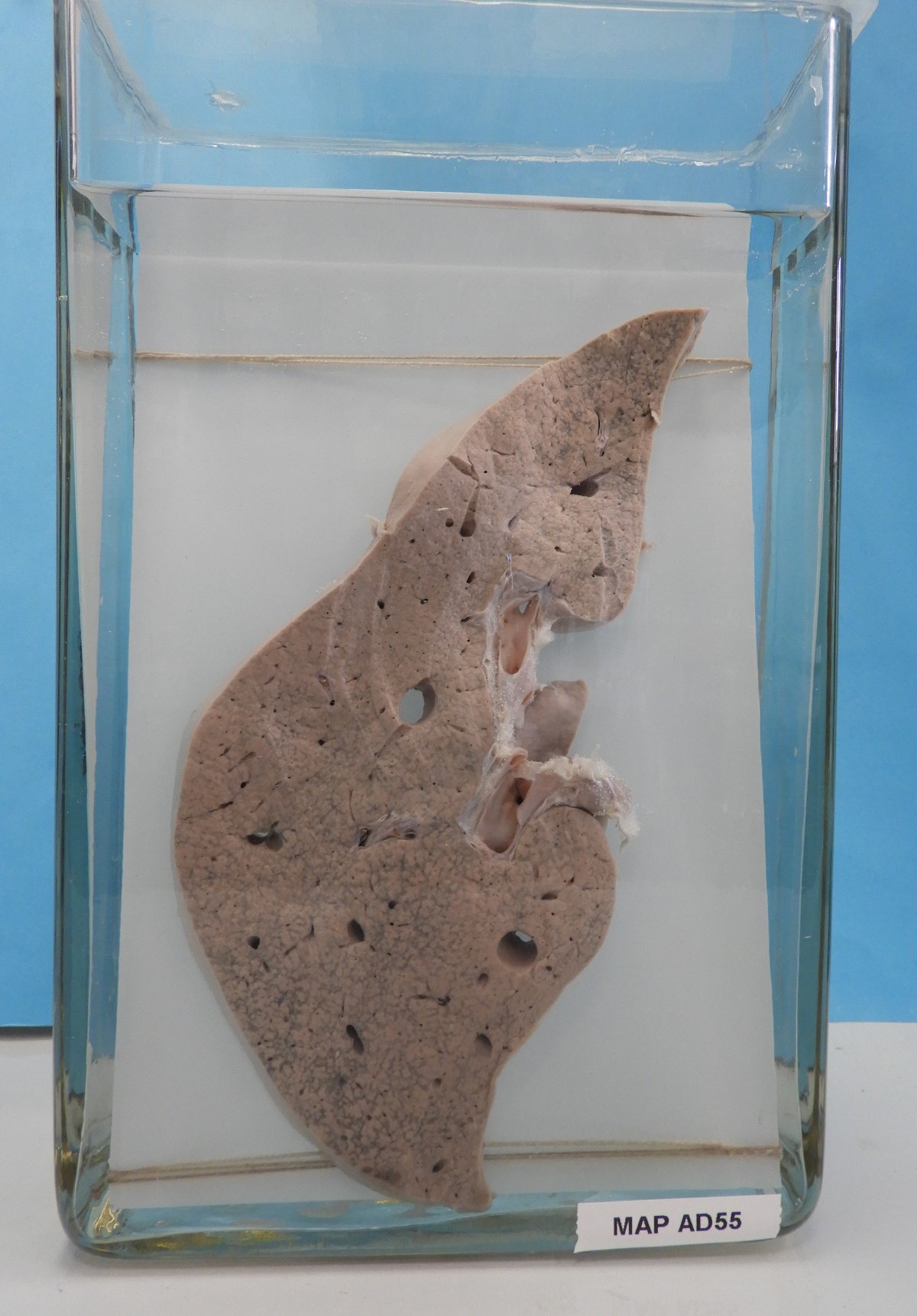 preparato anatomico, apparato digerente (morfologia naturale) (SECOLI/ XX)