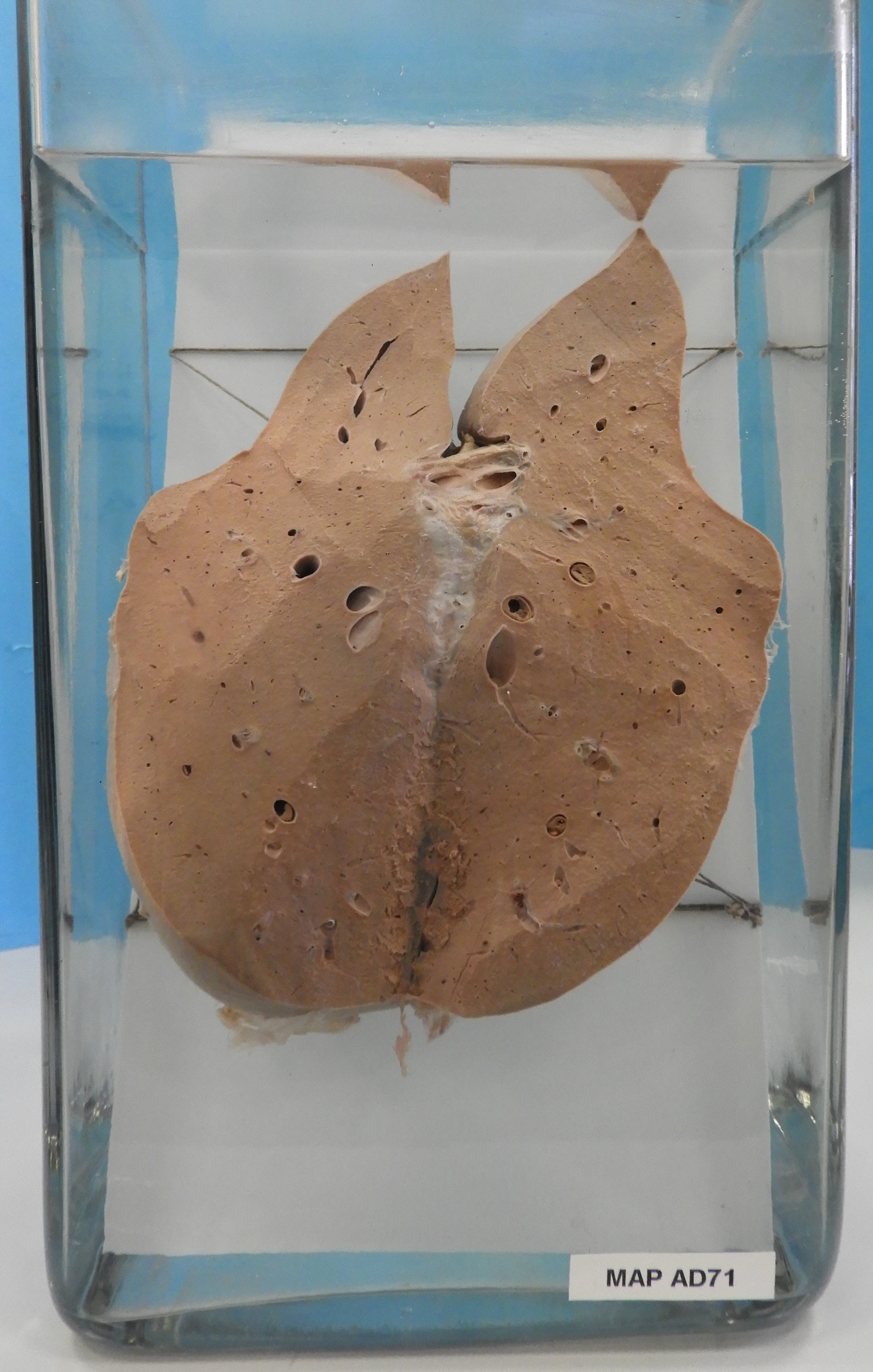 preparato anatomico, apparato digerente (morfologia naturale) (SECOLI/ XX)