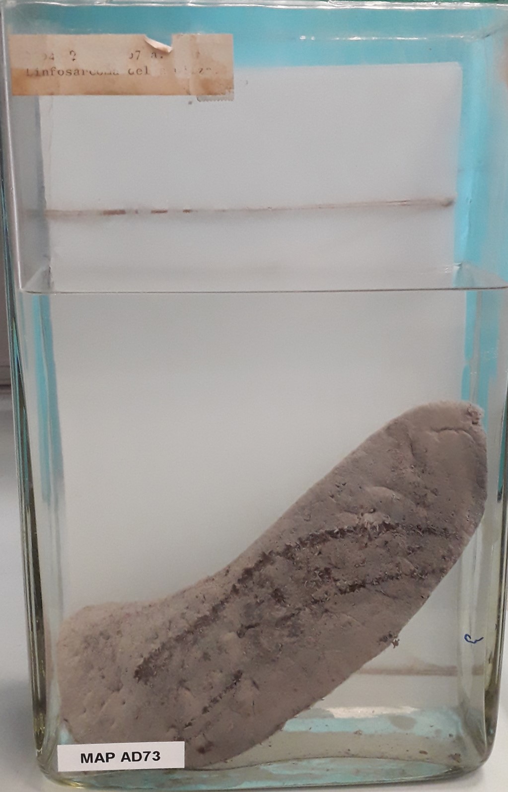 preparato anatomico, sistema linfatico (morfologia naturale) (SECOLI/ XX)