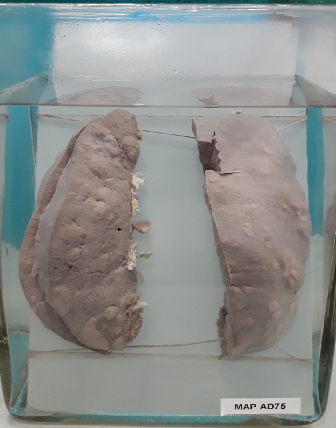 preparato anatomico, sistema linfatico (morfologia naturale) (SECOLI/ XX)