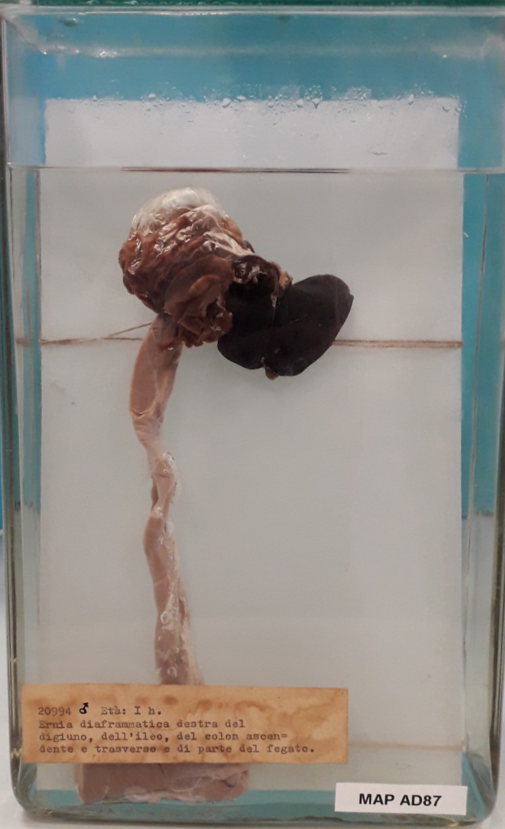 preparato anatomico, apparato digerente (morfologia naturale) (SECOLI/ XX)