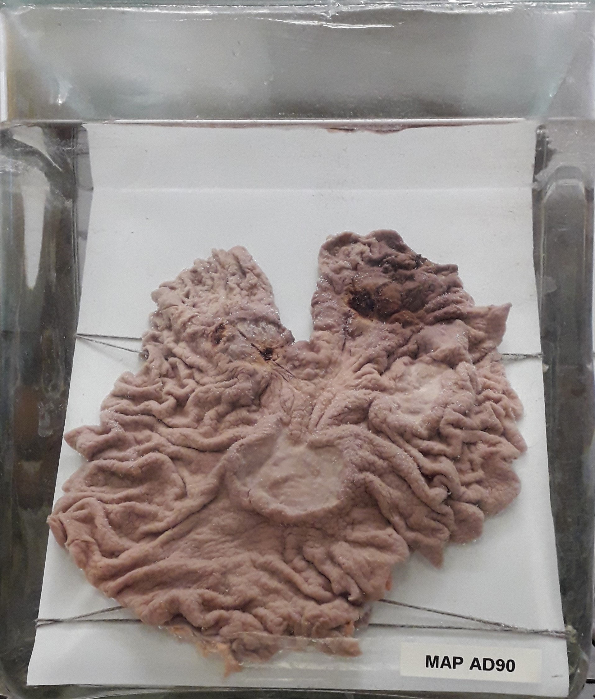 preparato anatomico, apparato digerente (morfologia naturale) (SECOLI/ XX)