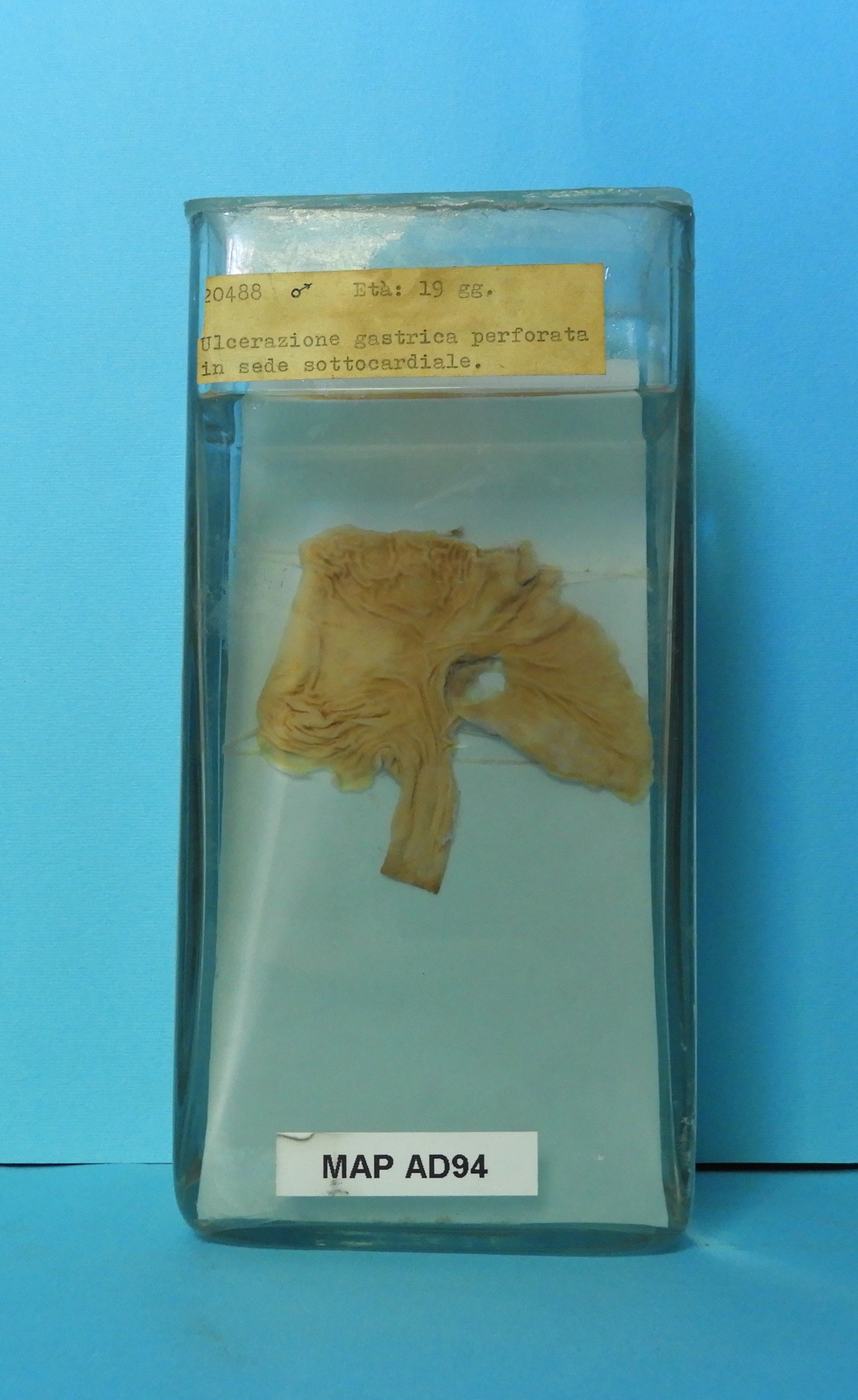 preparato anatomico, apparato digerente (morfologia naturale) (SECOLI/ XX)