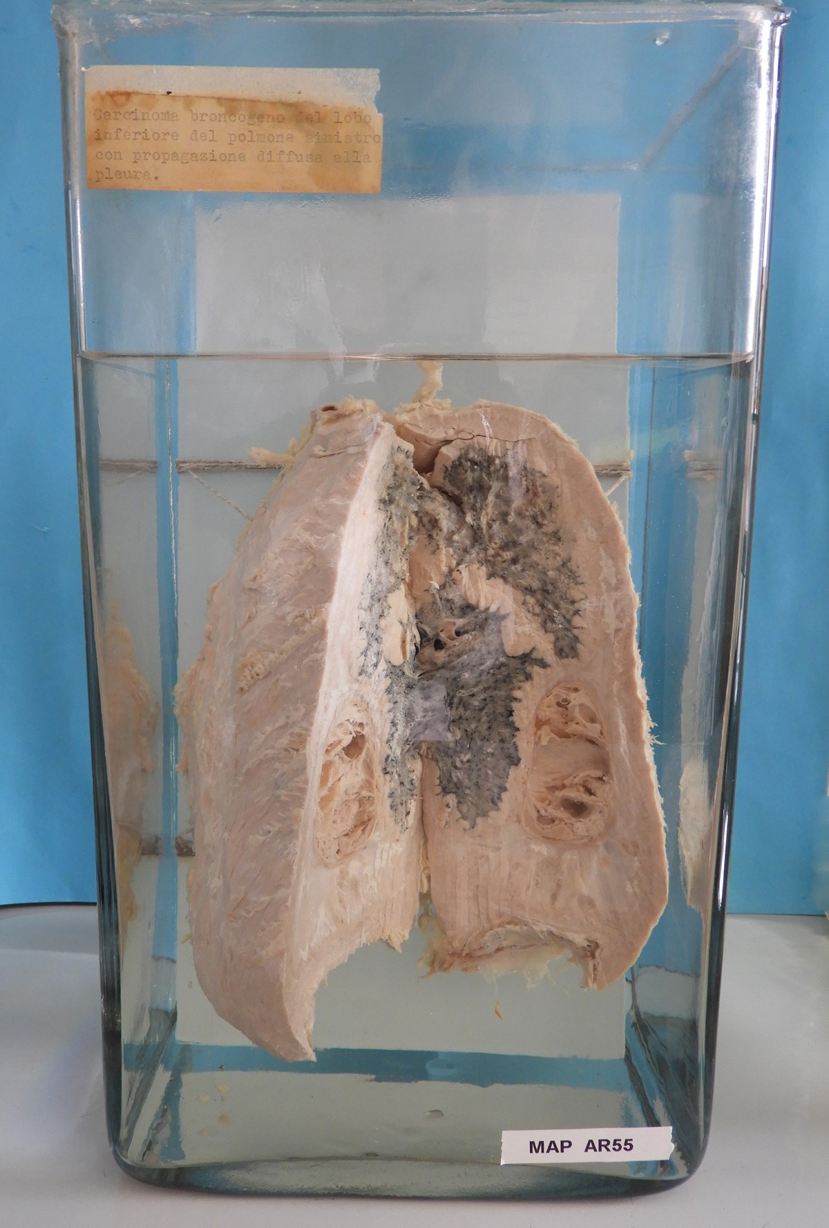 preparato anatomico, apparato respiratorio (morfologia naturale) (SECOLI/ XX)