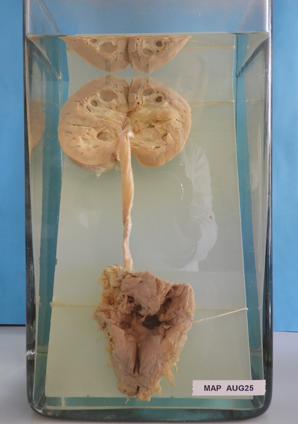 preparato anatomico, apparato urogenitale (morfologia naturale) (SECOLI/ XX)