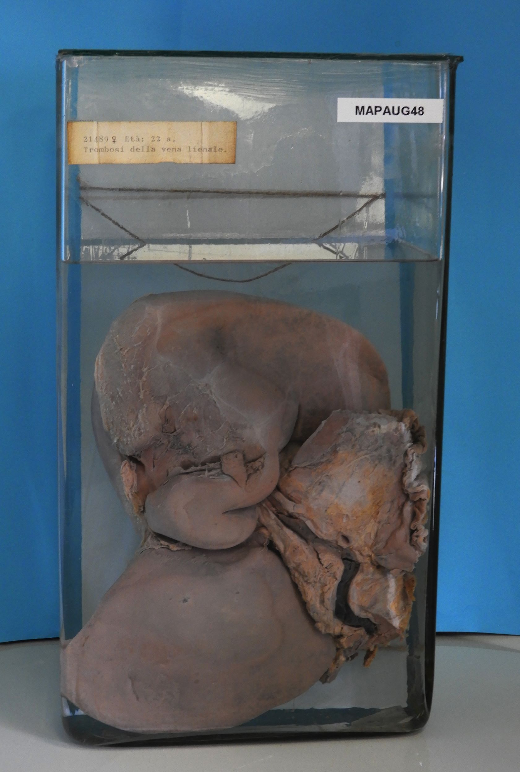 preparato anatomico, apparato urogenitale (morfologia naturale) (SECOLI/ XX)