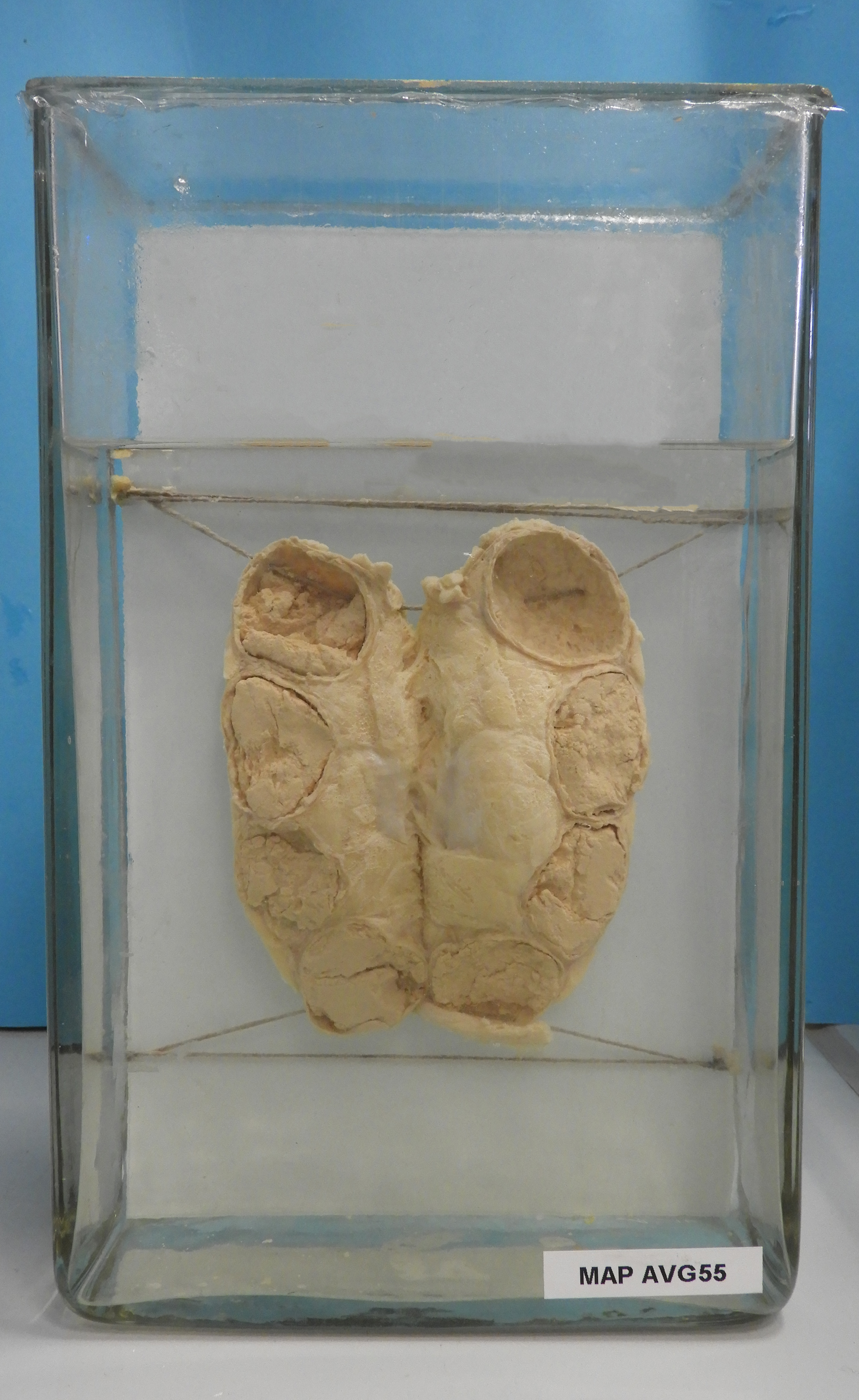 preparato anatomico, apparato urogenitale (morfologia naturale) (SECOLI/ XX)