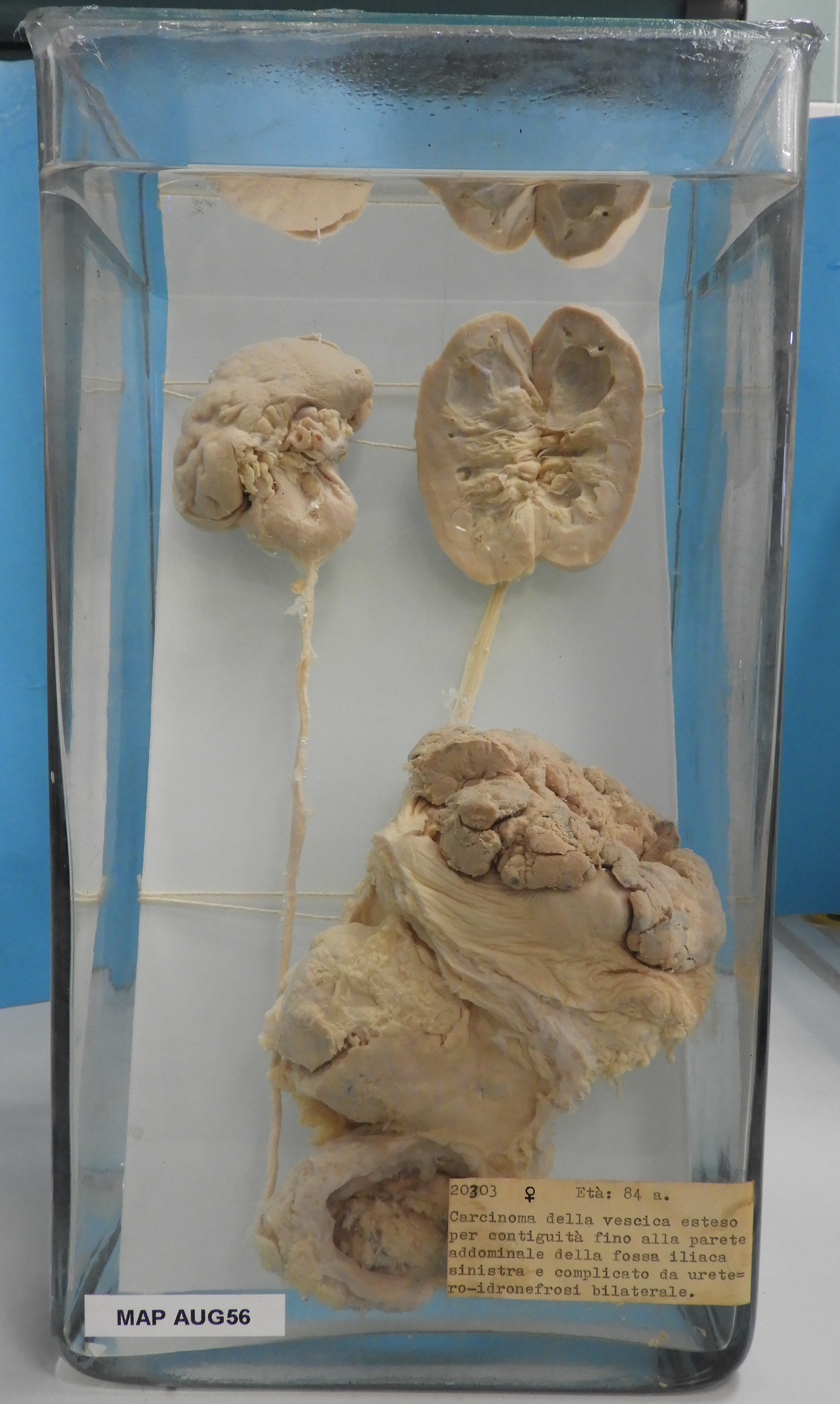 preparato anatomico, apparato urogenitale (morfologia naturale) (SECOLI/ XX)