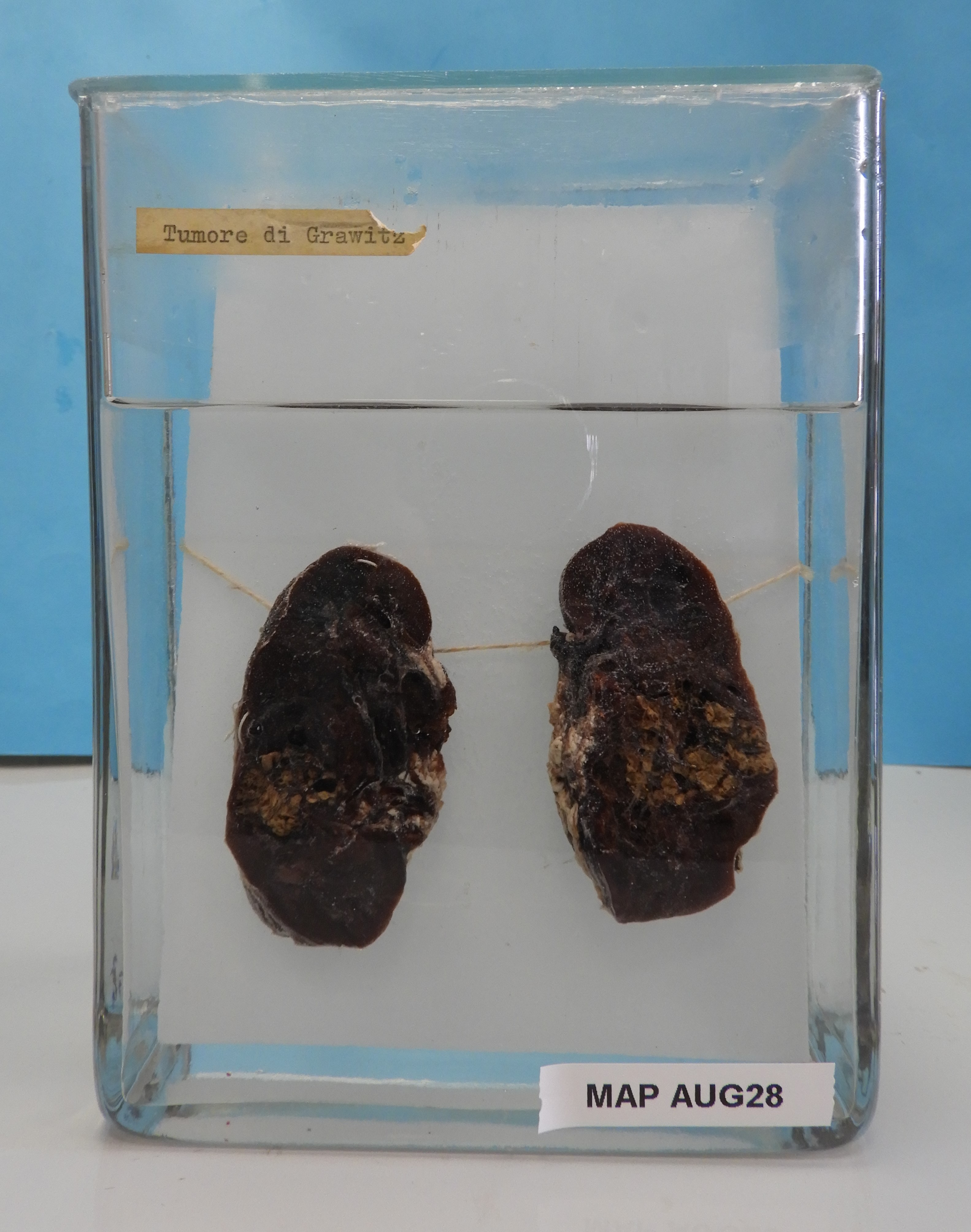 preparato anatomico, apparato urogenitale (morfologia naturale) (SECOLI/ XX)