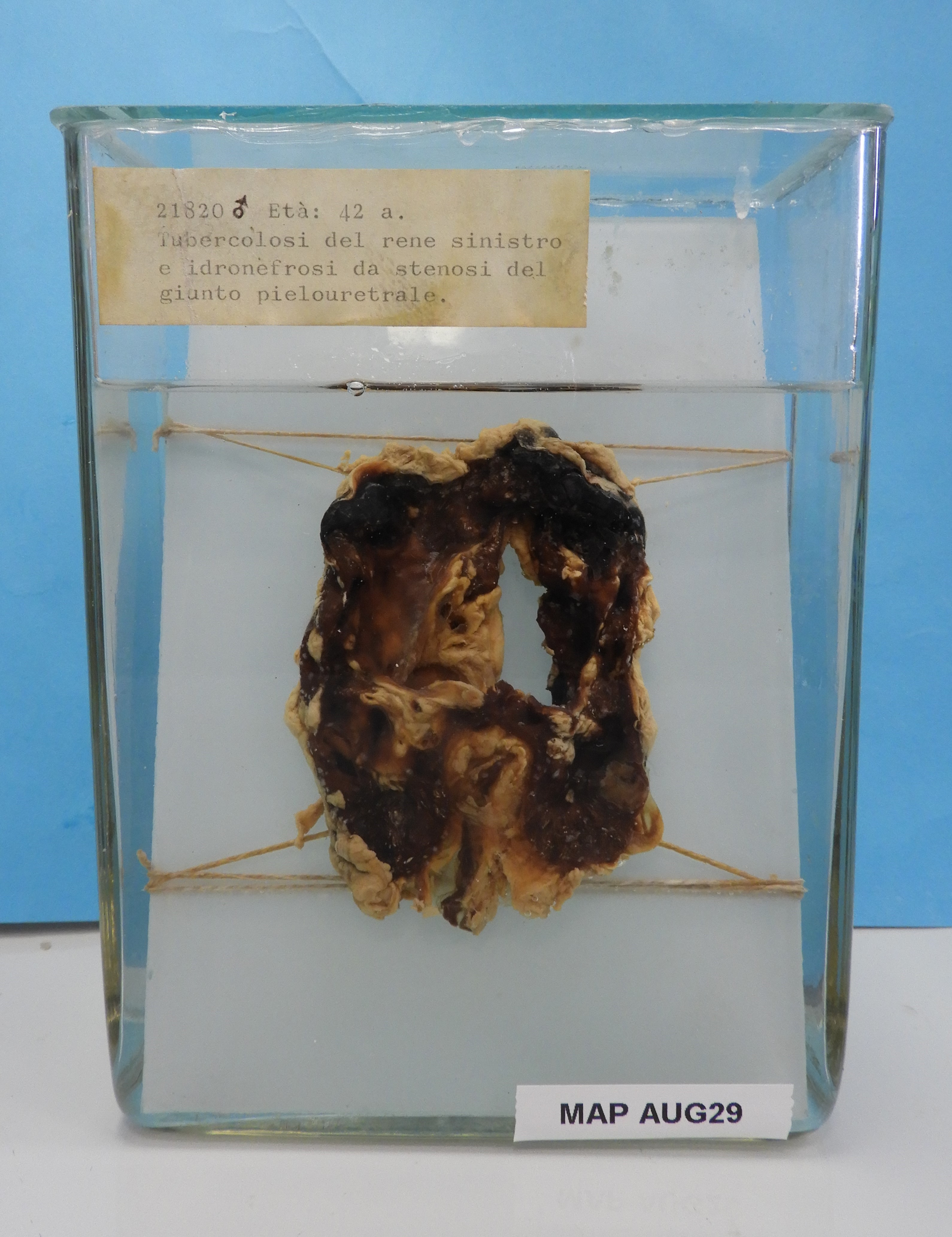 preparato anatomico, apparato urogenitale (morfologia naturale) (SECOLI/ XX)