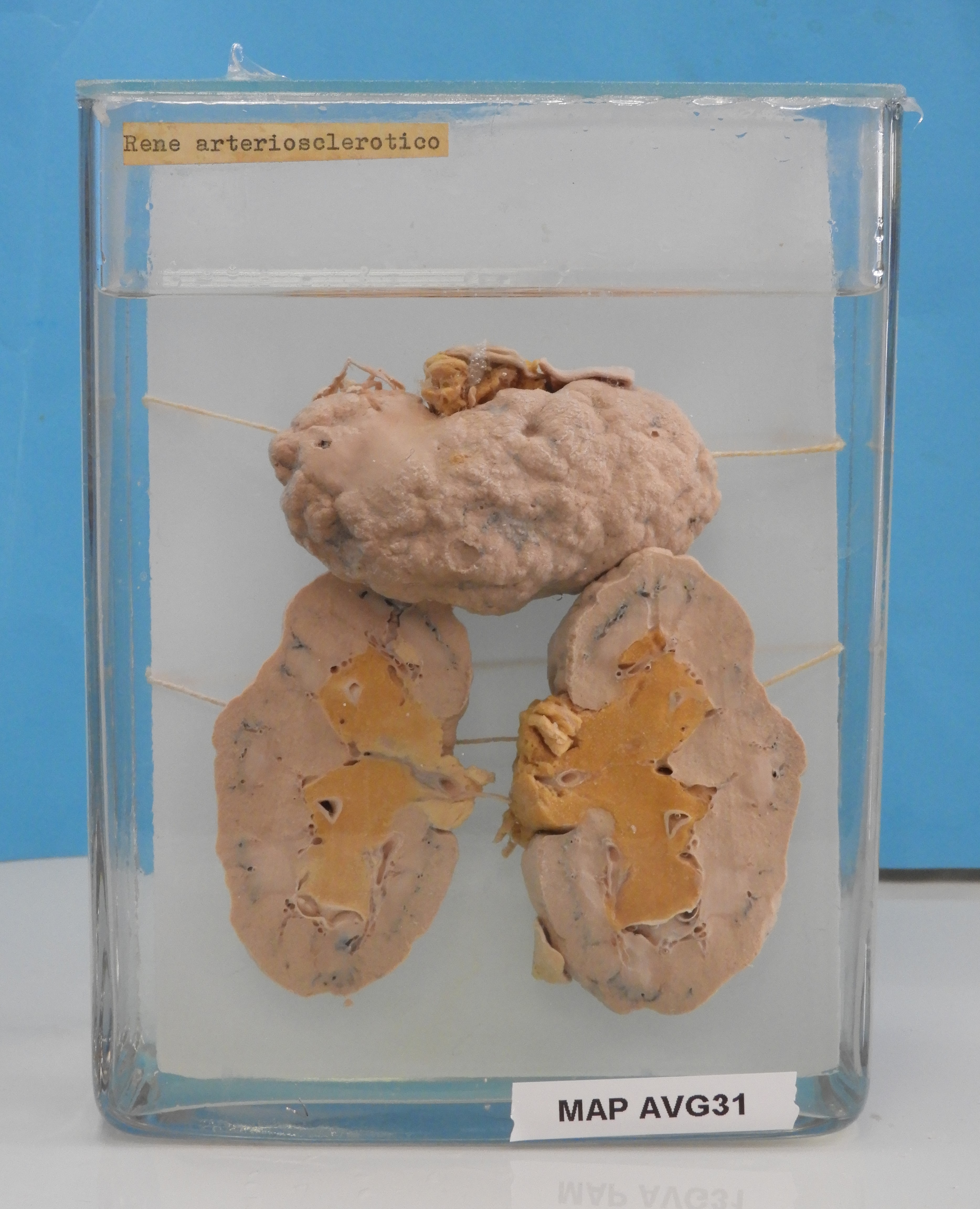 preparato anatomico, apparato urogenitale (morfologia naturale) (SECOLI/ XX)