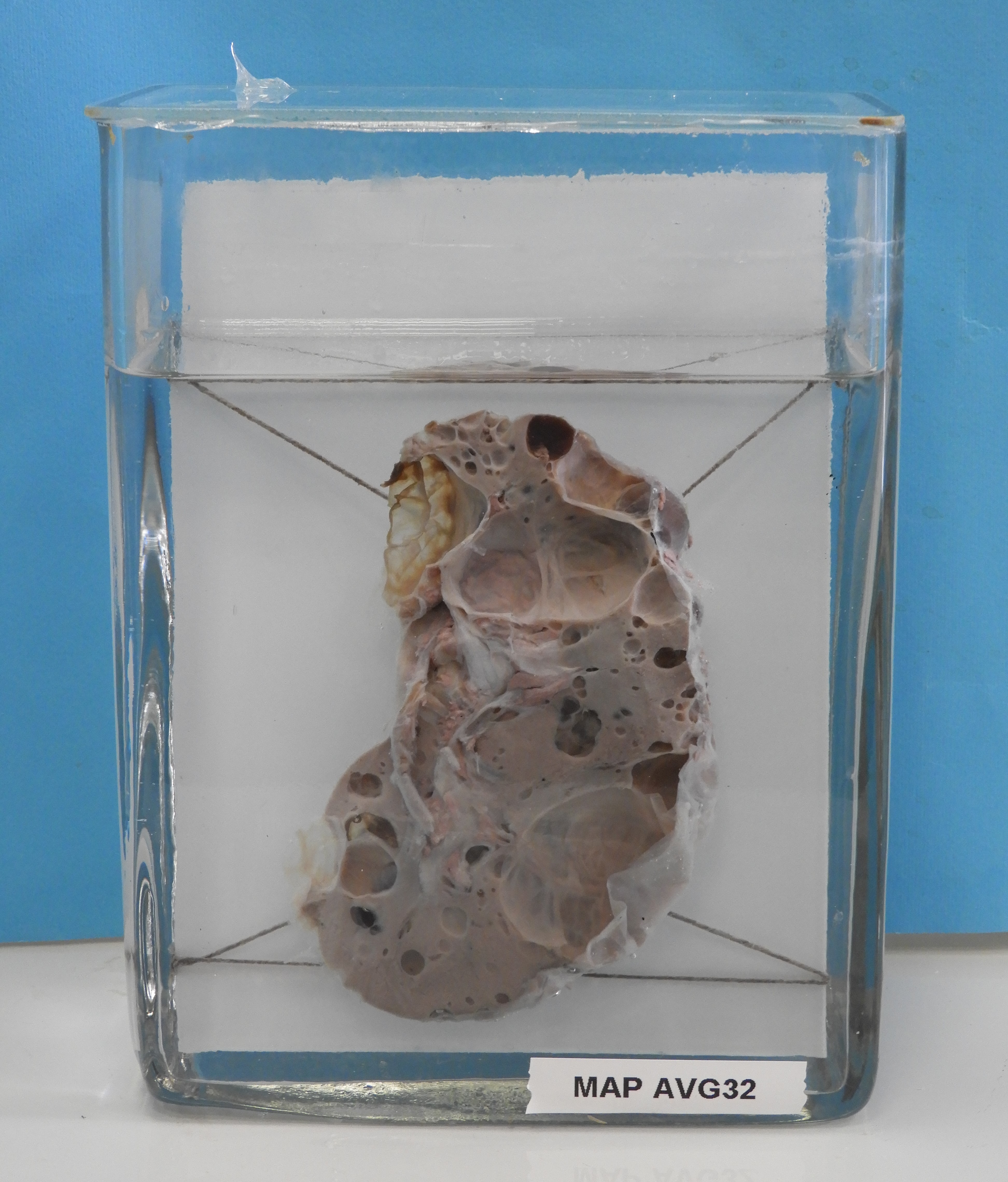 preparato anatomico, apparato urogenitale (morfologia naturale) (SECOLI/ XX)