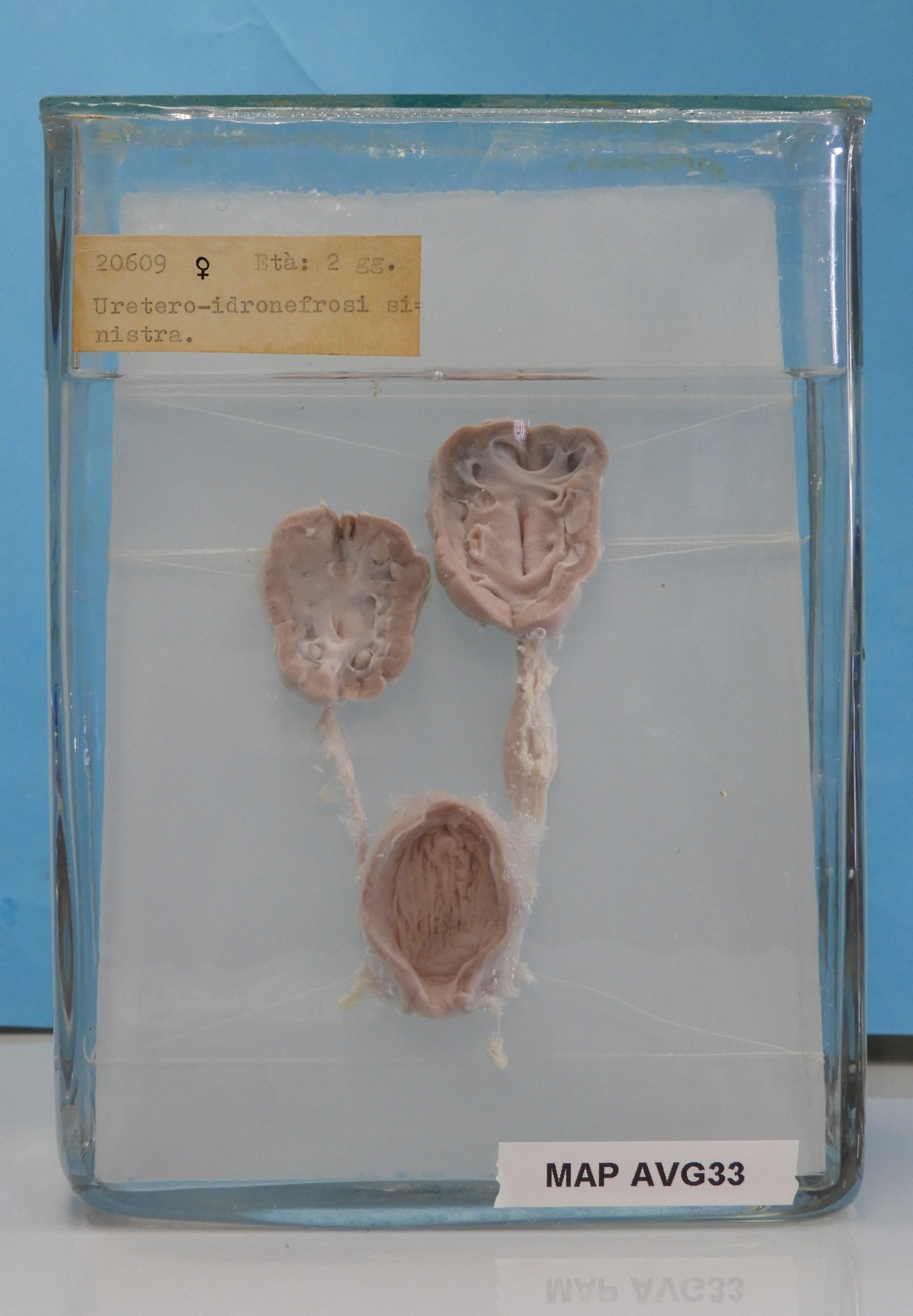 preparato anatomico, apparato urogenitale (morfologia naturale) (SECOLI/ XX)