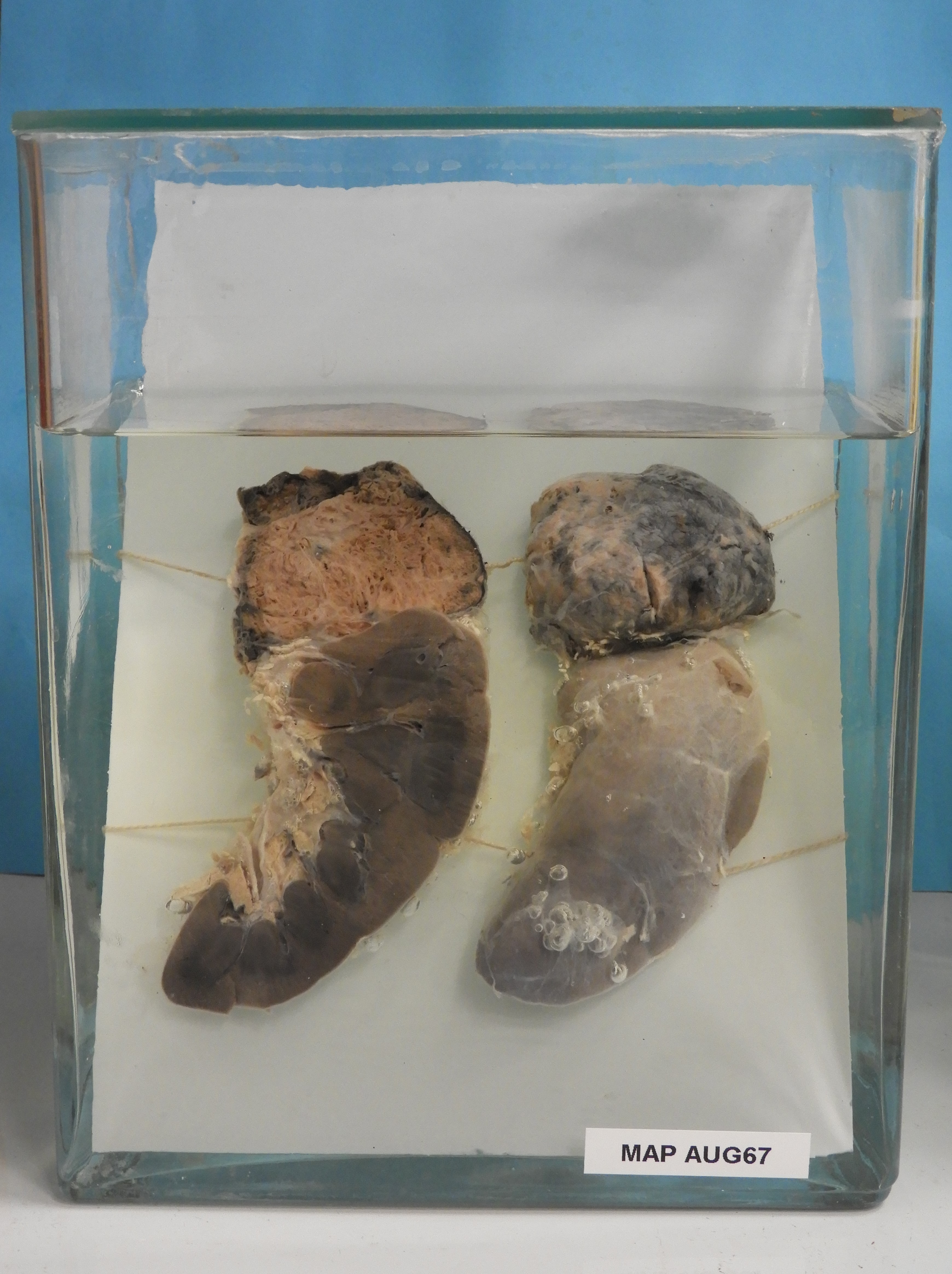 preparato anatomico, apparato urogenitale (morfologia naturale) (SECOLI/ XX)