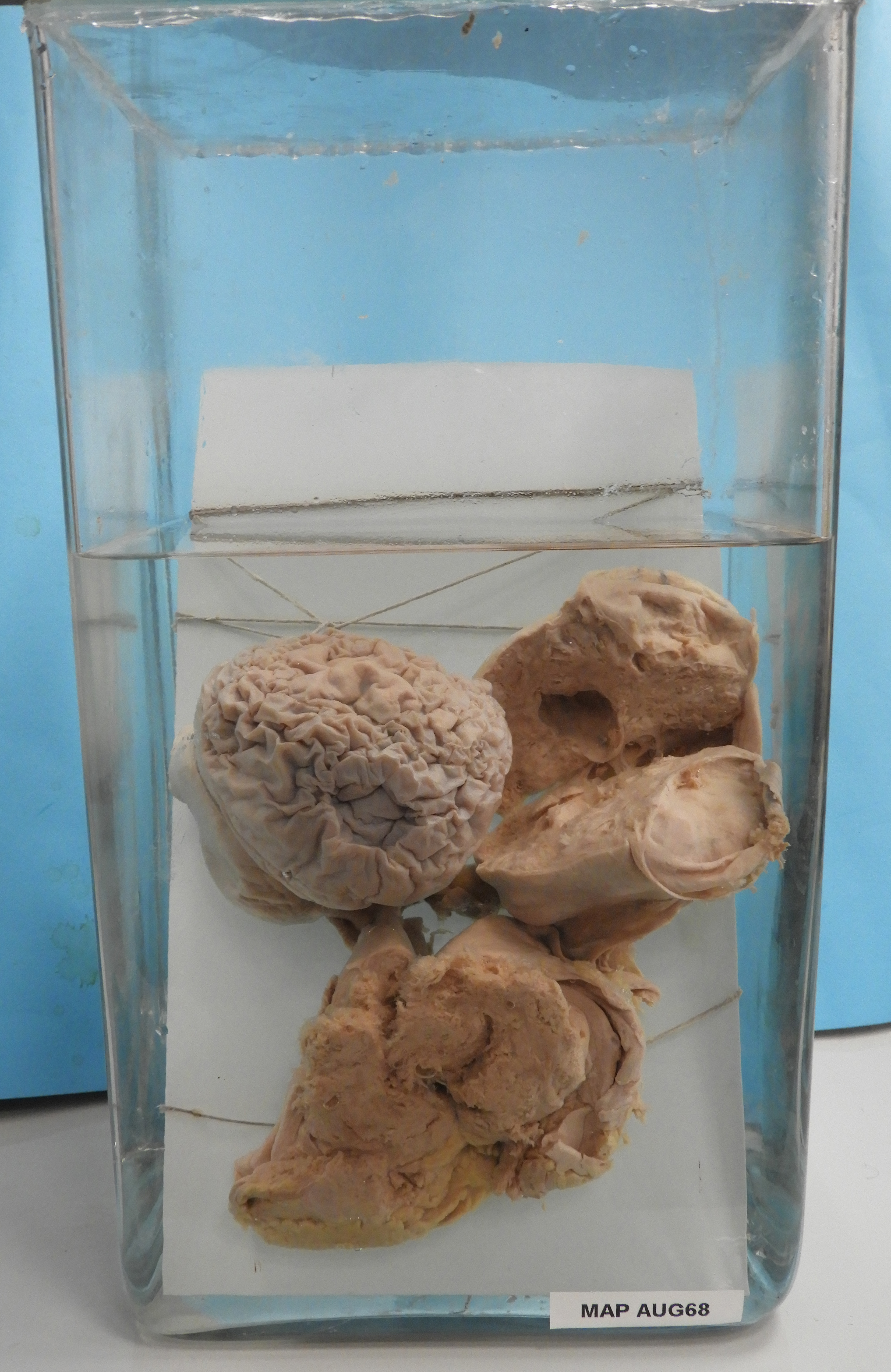 preparato anatomico, apparato urogenitale (morfologia naturale) (SECOLI/ XX)