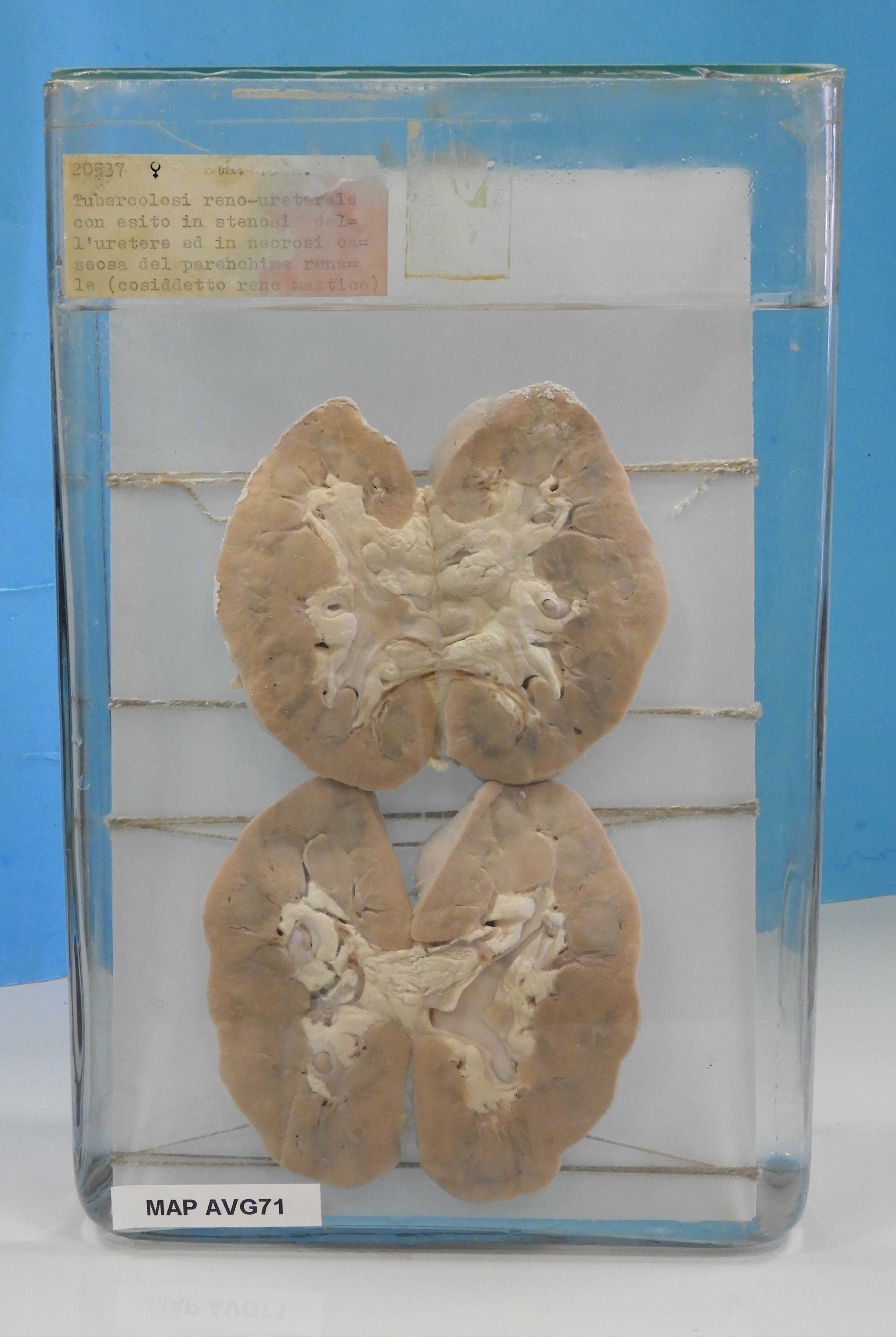 preparato anatomico, apparato urogenitale (morfologia naturale) (SECOLI/ XX)