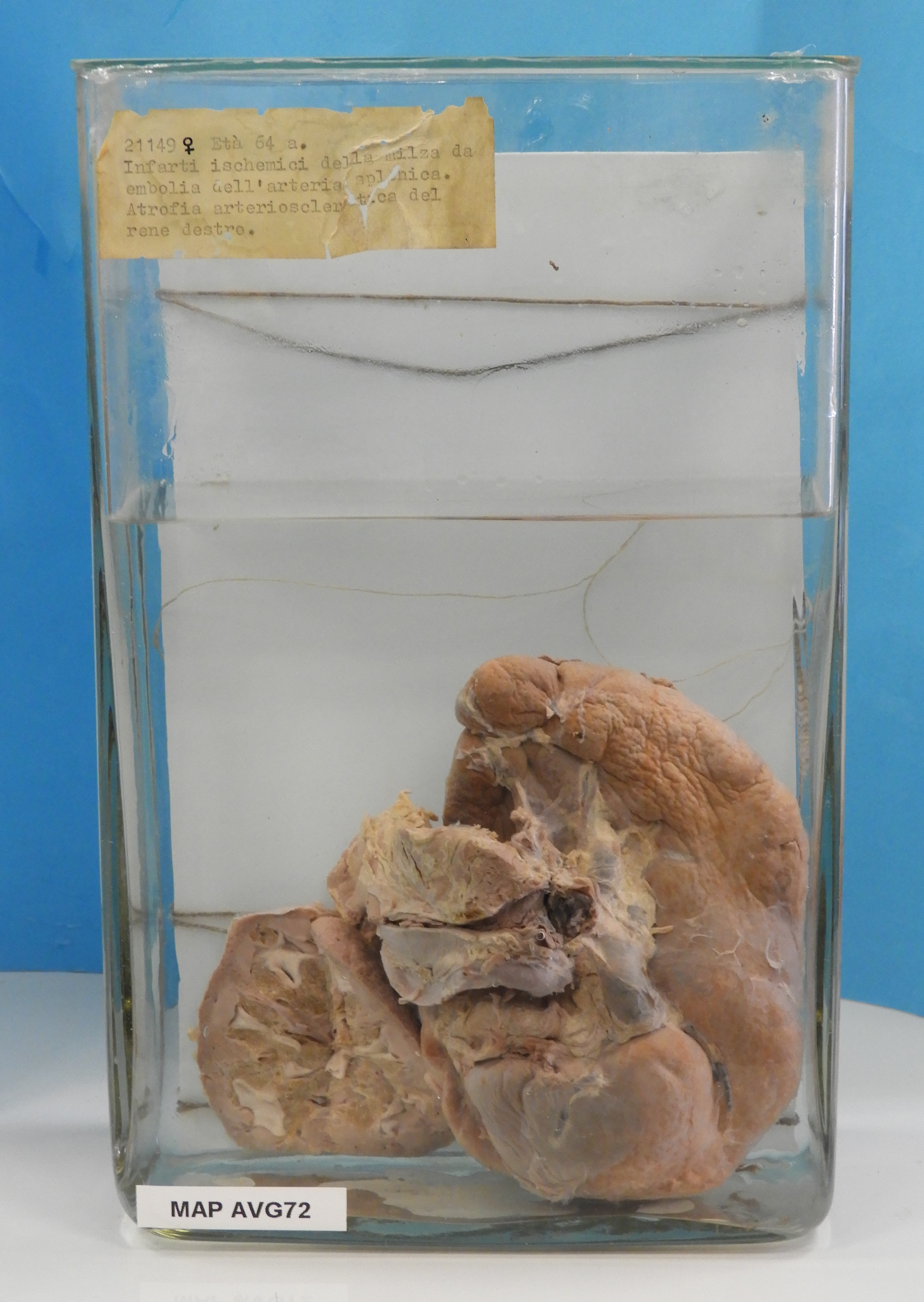 preparato anatomico, apparato urogenitale (morfologia naturale) (SECOLI/ XX)