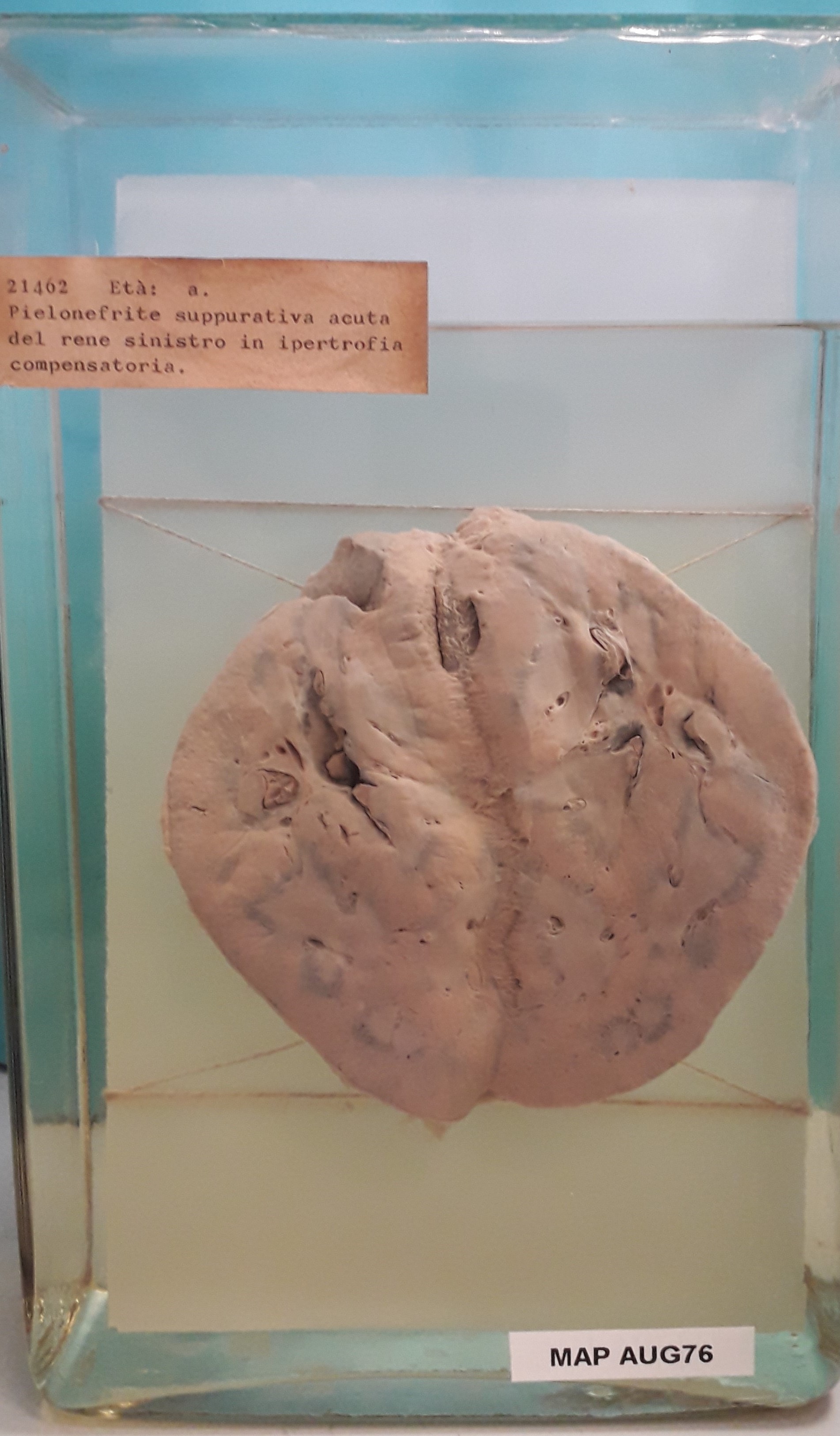 preparato anatomico, apparato urogenitale (morfologia naturale) (SECOLI/ XX)