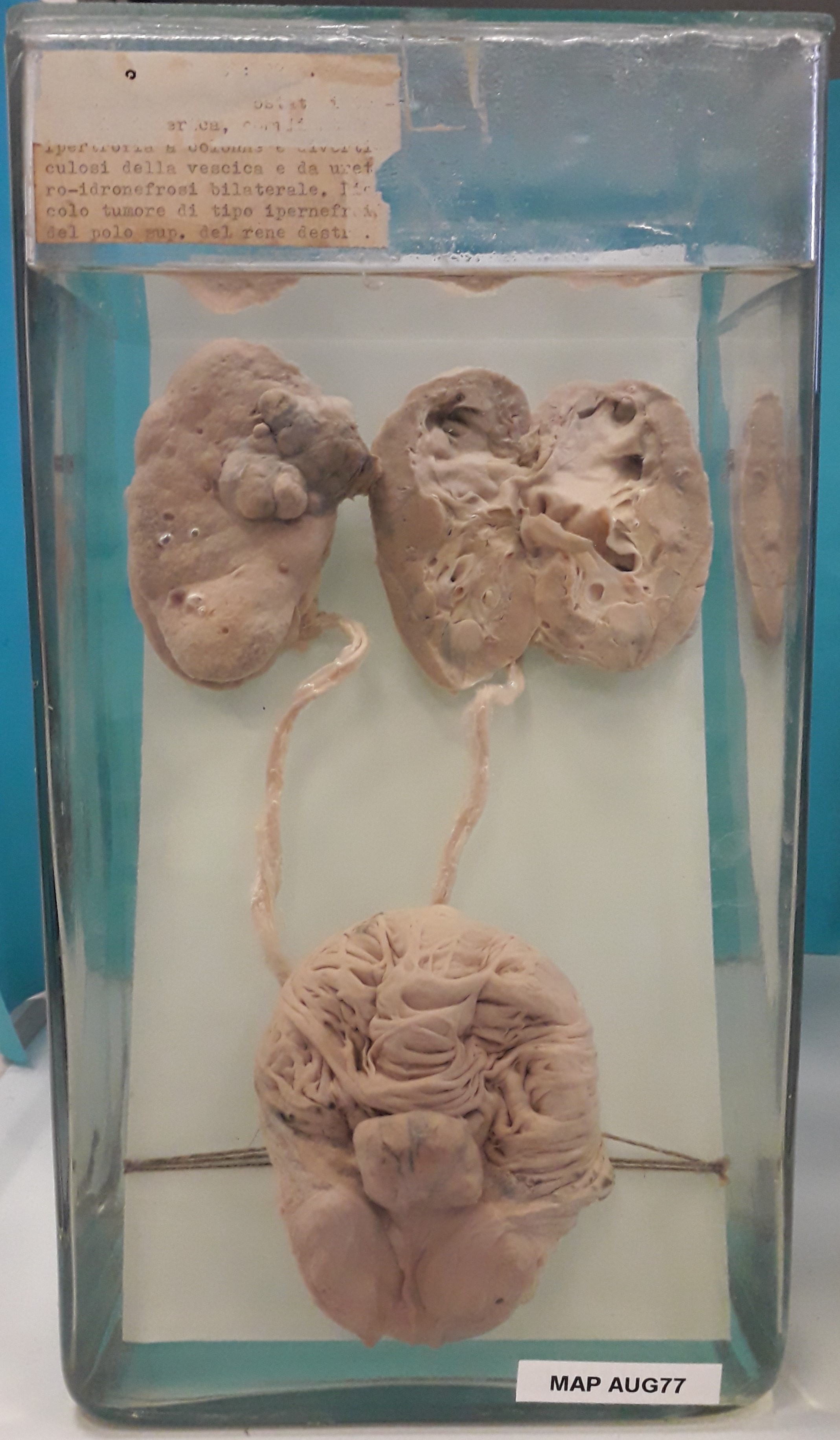 preparato anatomico, apparato urogenitale (morfologia naturale) (SECOLI/ XX)