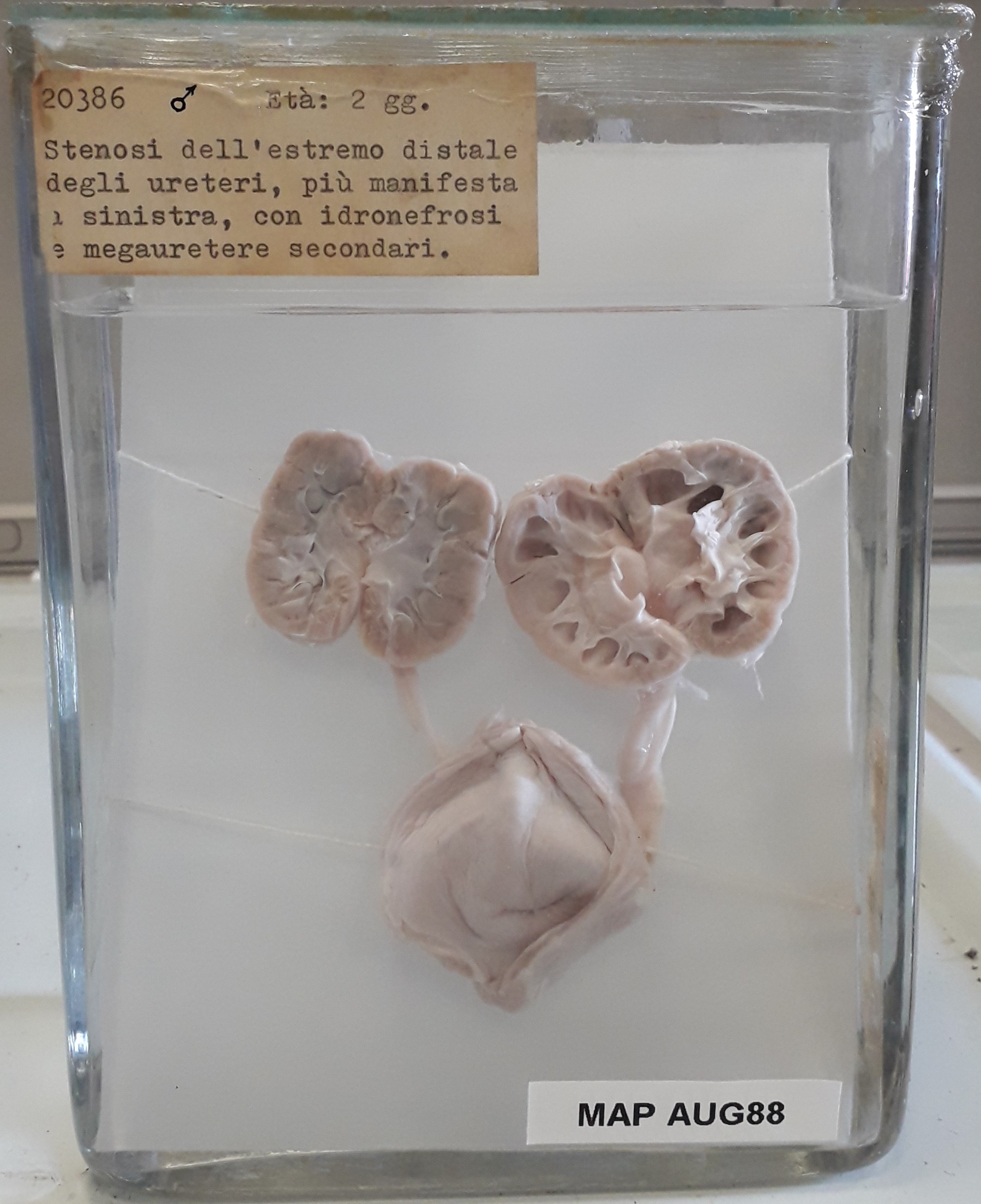 preparato anatomico, apparato urogenitale (morfologia naturale) (SECOLI/ XX)