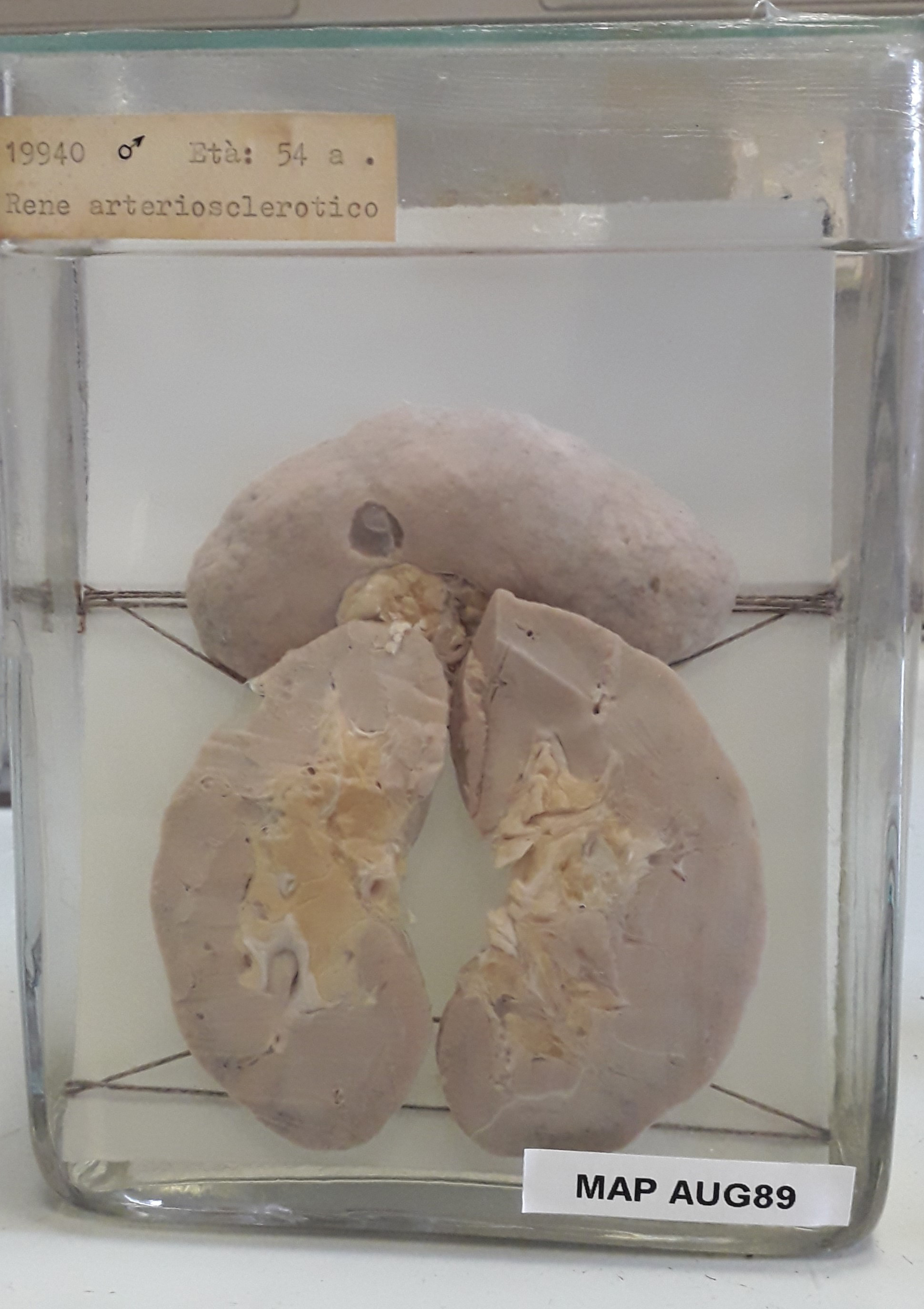 preparato anatomico, apparato urogenitale (morfologia naturale) (SECOLI/ XX)