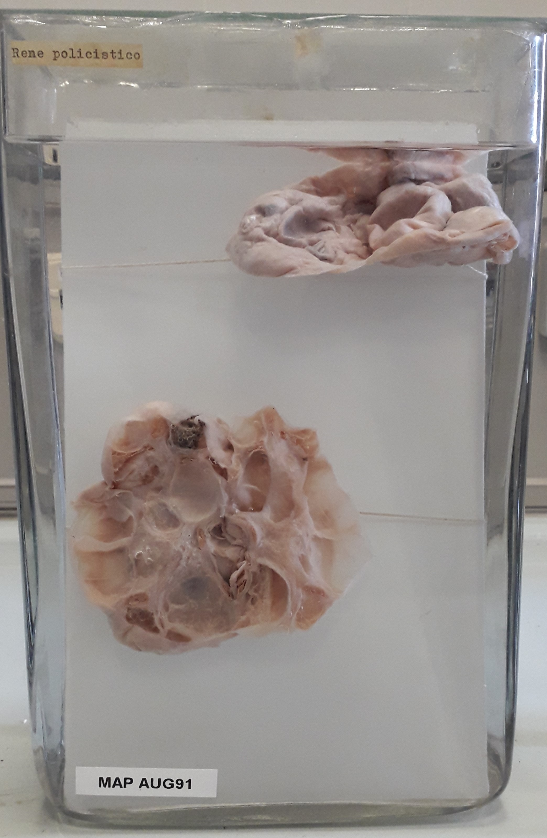 preparato anatomico, apparato urogenitale (morfologia naturale) (SECOLI/ XX)