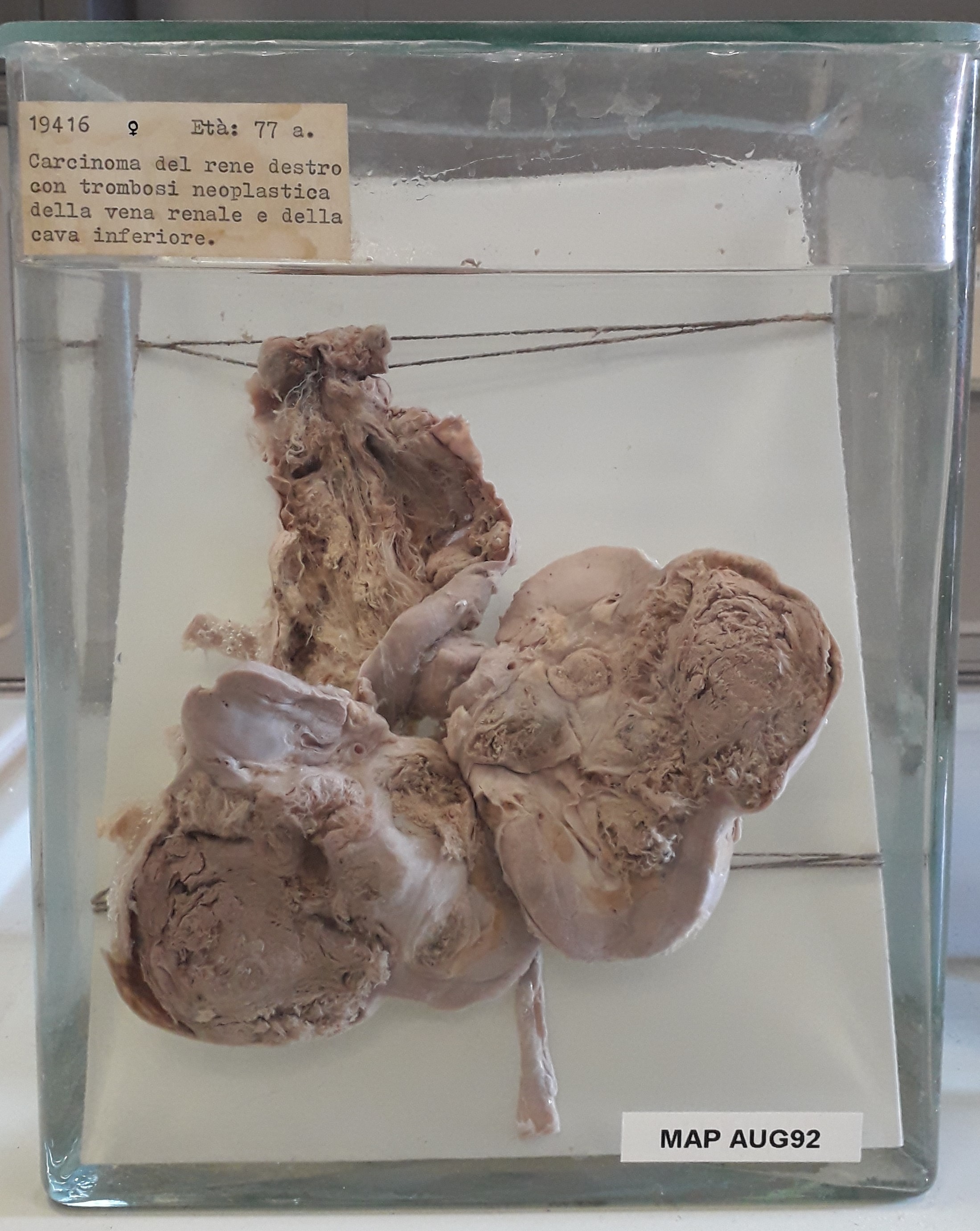 preparato anatomico, apparato urogenitale (morfologia naturale) (SECOLI/ XX)