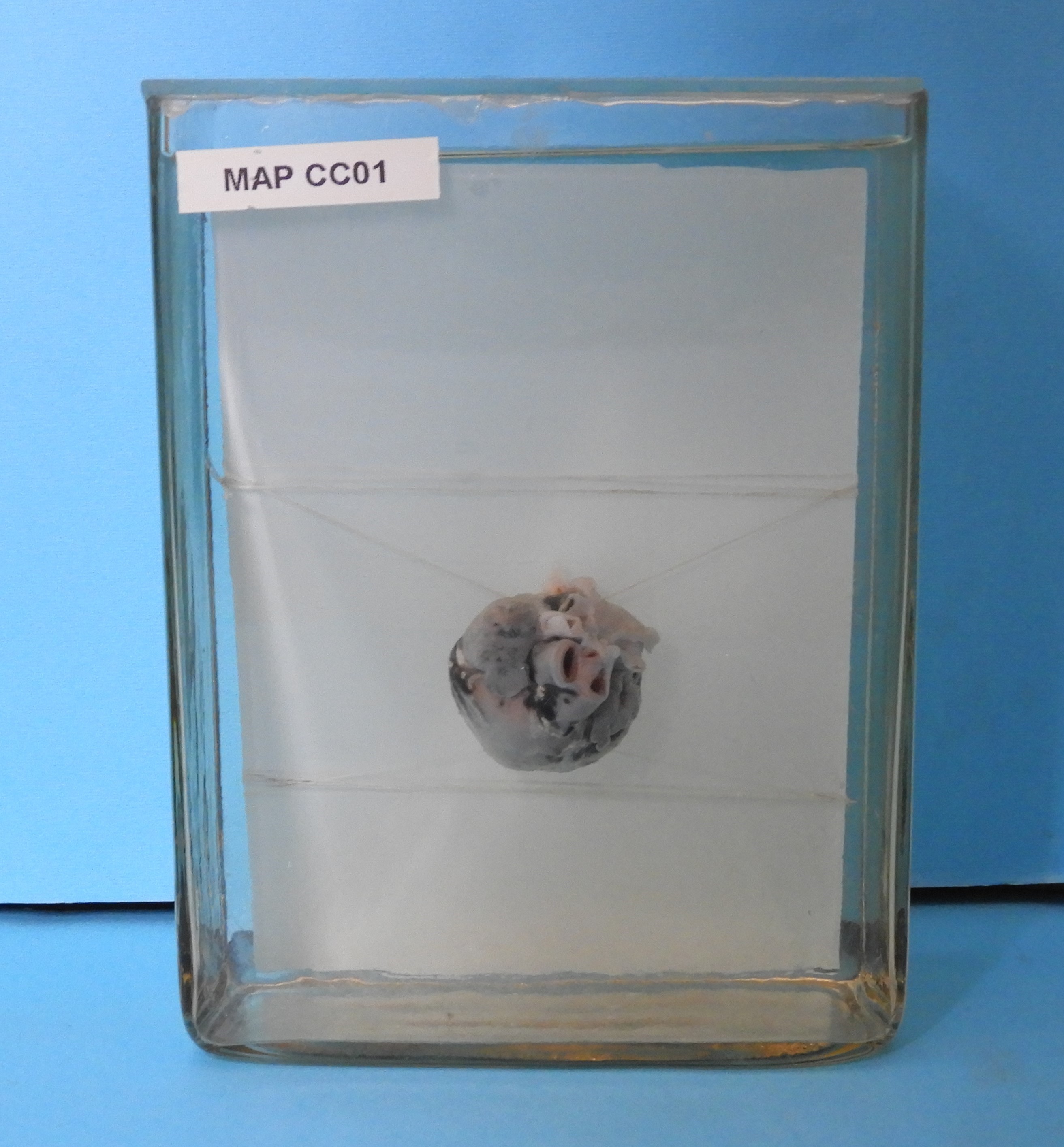 preparato anatomico, apparato cardiocircolatorio (morfologia naturale) (SECOLI/ XX)