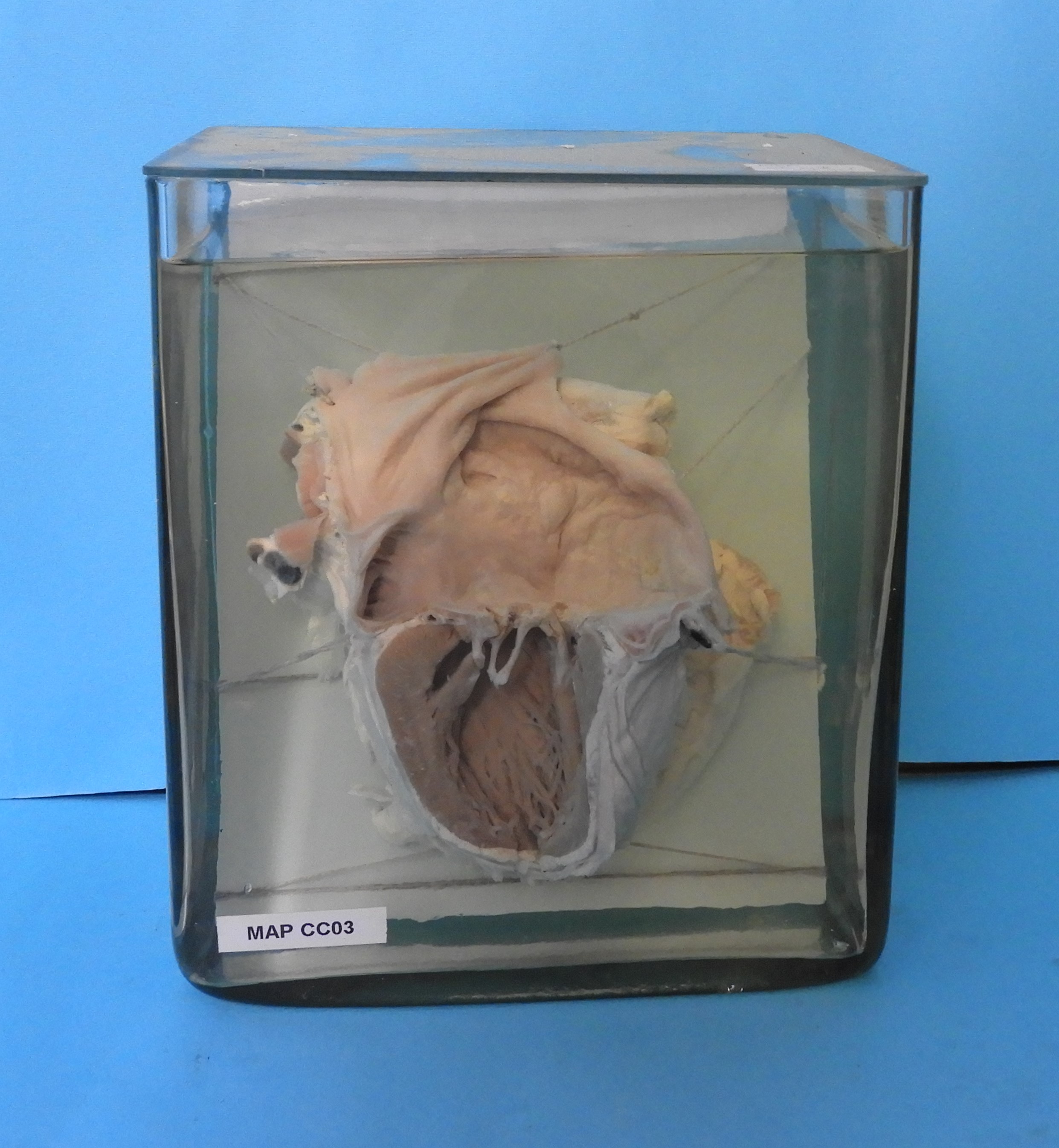 preparato anatomico, apparato cardiocircolatorio (morfologia naturale) (SECOLI/ XX)