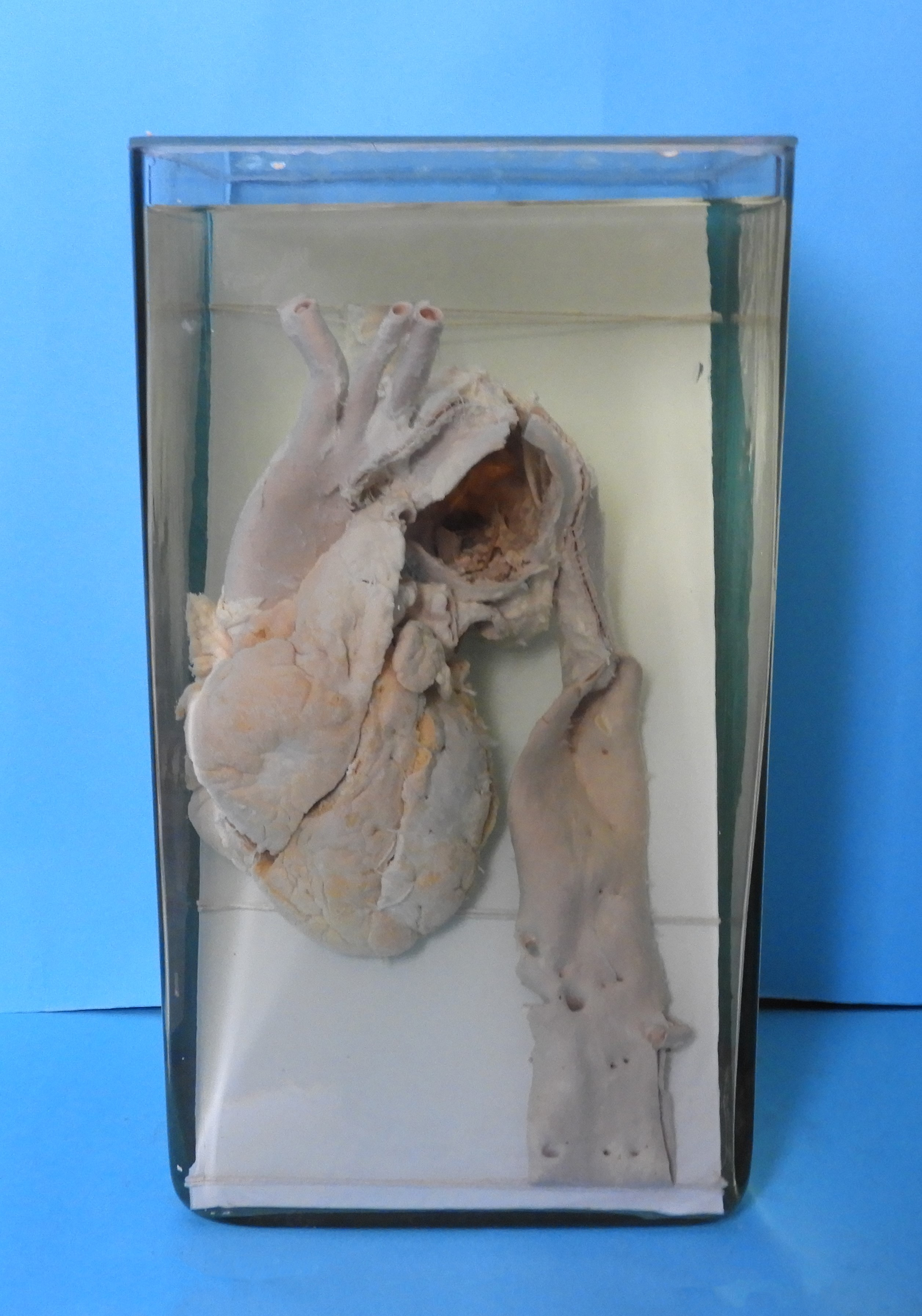 preparato anatomico, apparato cardiocircolatorio (morfologia naturale) (SECOLI/ XX)