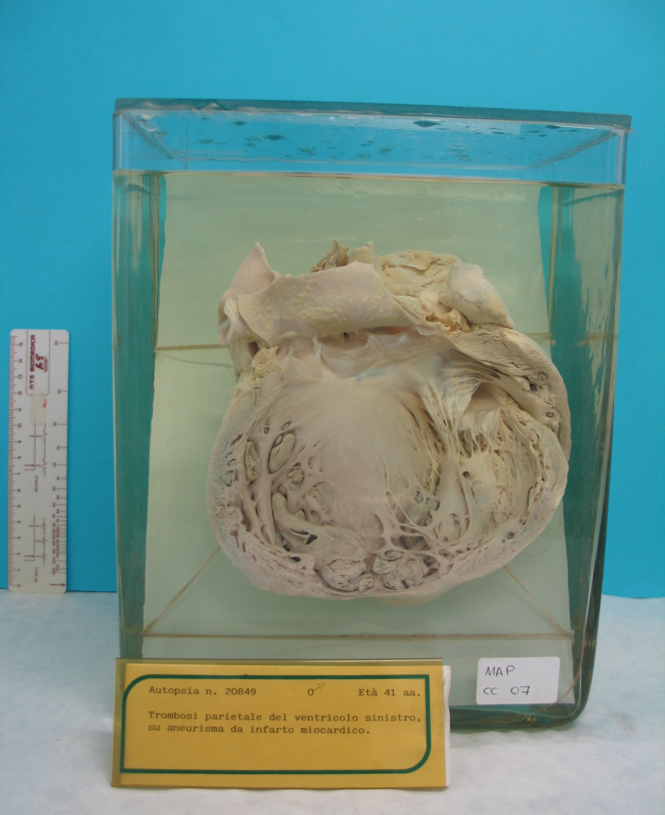 preparato anatomico, apparato cardiocircolatorio (morfologia naturale) (SECOLI/ XX)