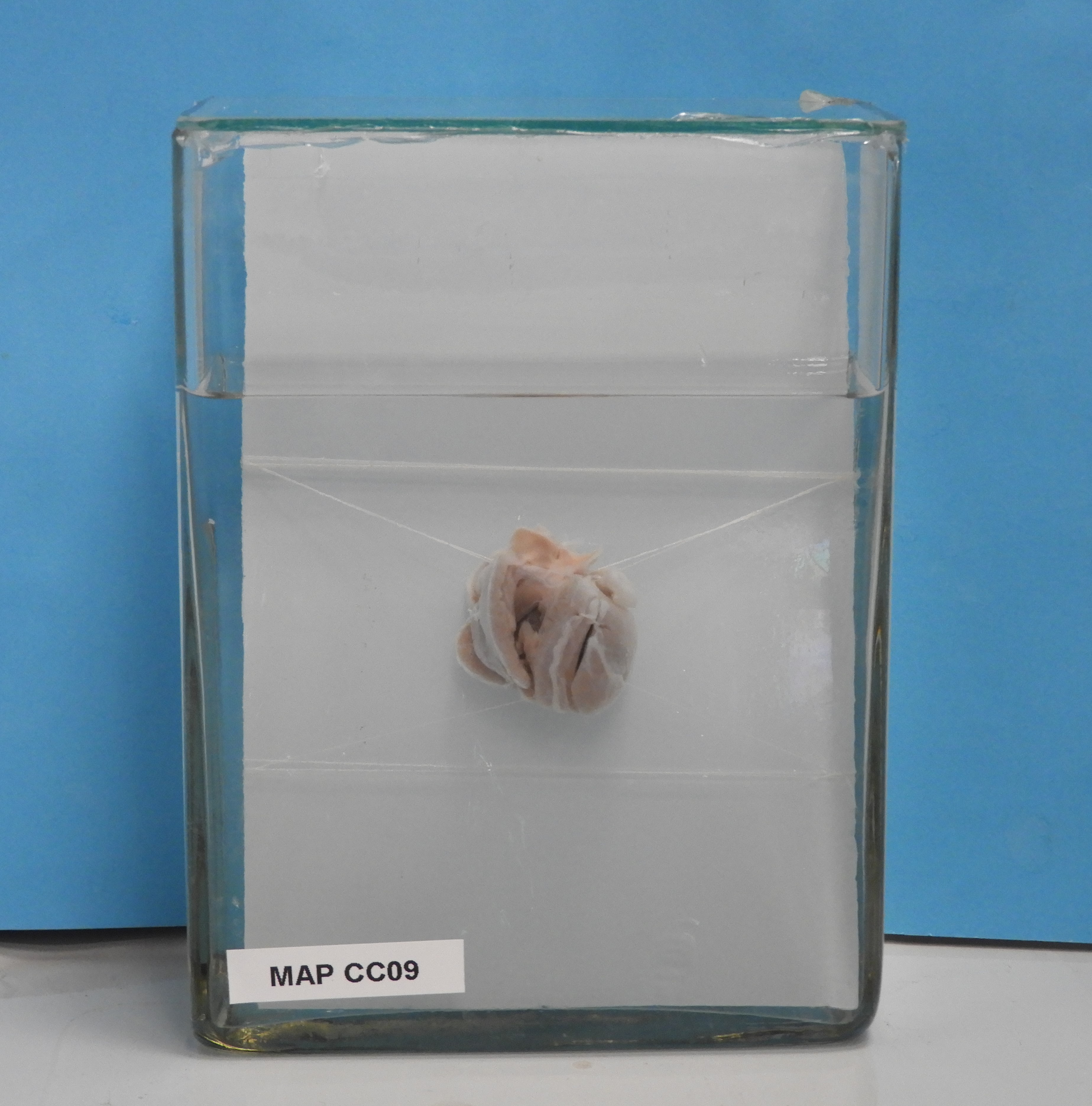 preparato anatomico, apparato cardiocircolatorio (morfologia naturale) (SECOLI/ XX)