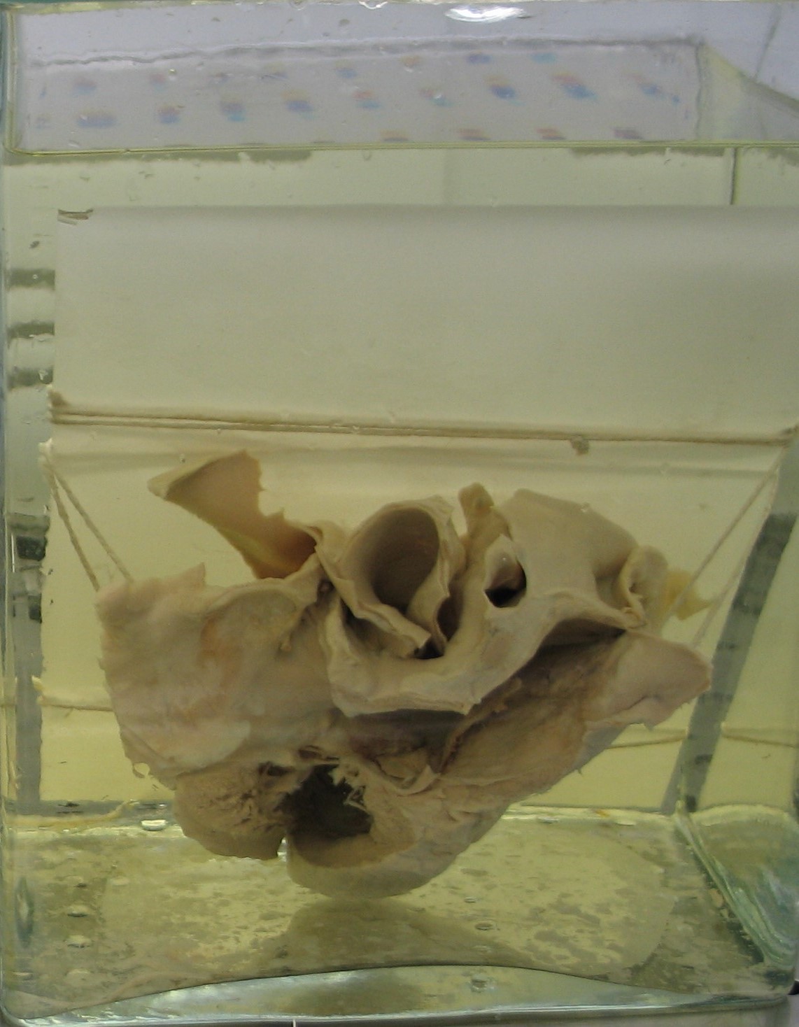 preparato anatomico, apparato cardiocircolatorio (morfologia naturale) (SECOLI/ XX)