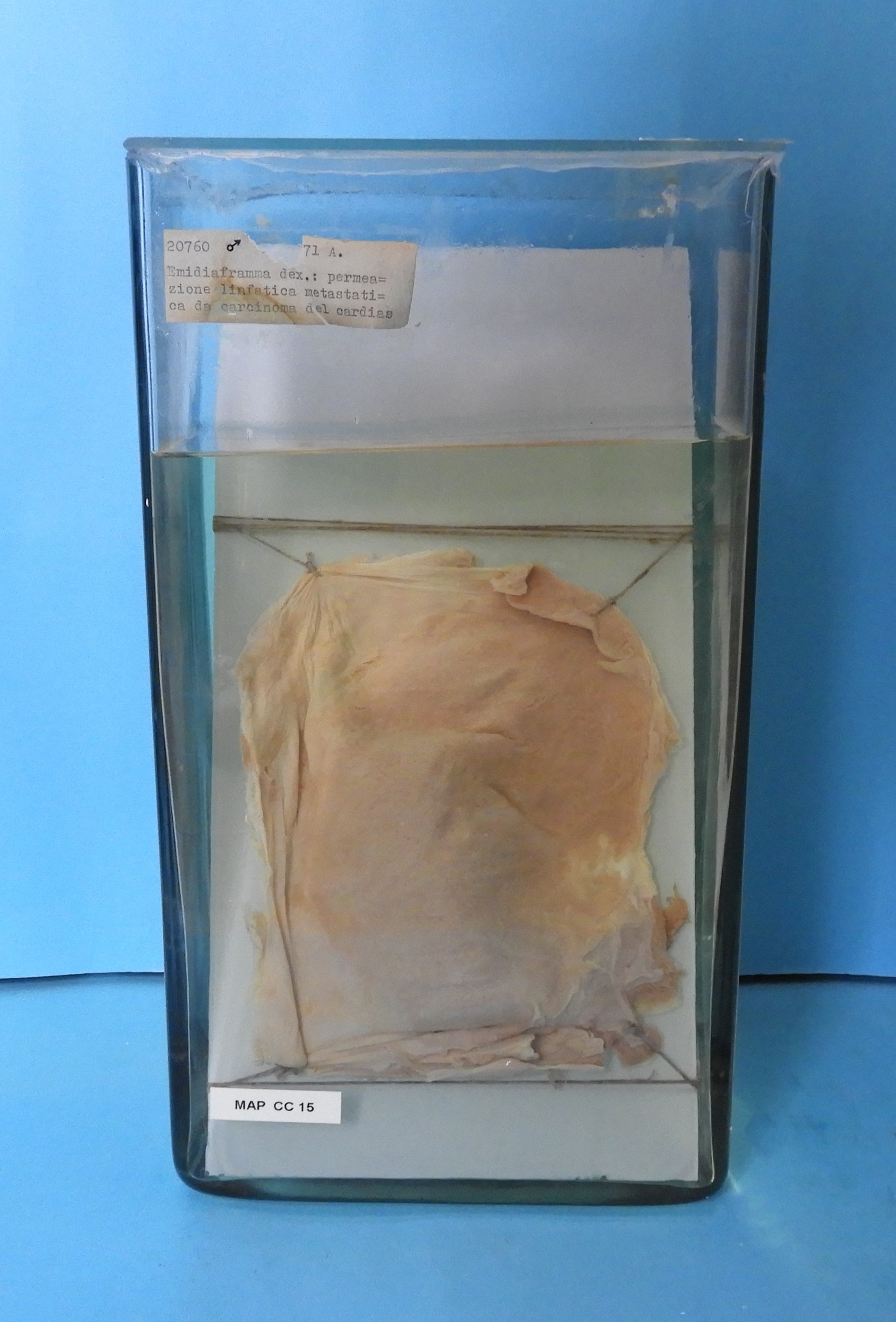 preparato anatomico, apparato cardiocircolatorio (morfologia naturale) (SECOLI/ XX)