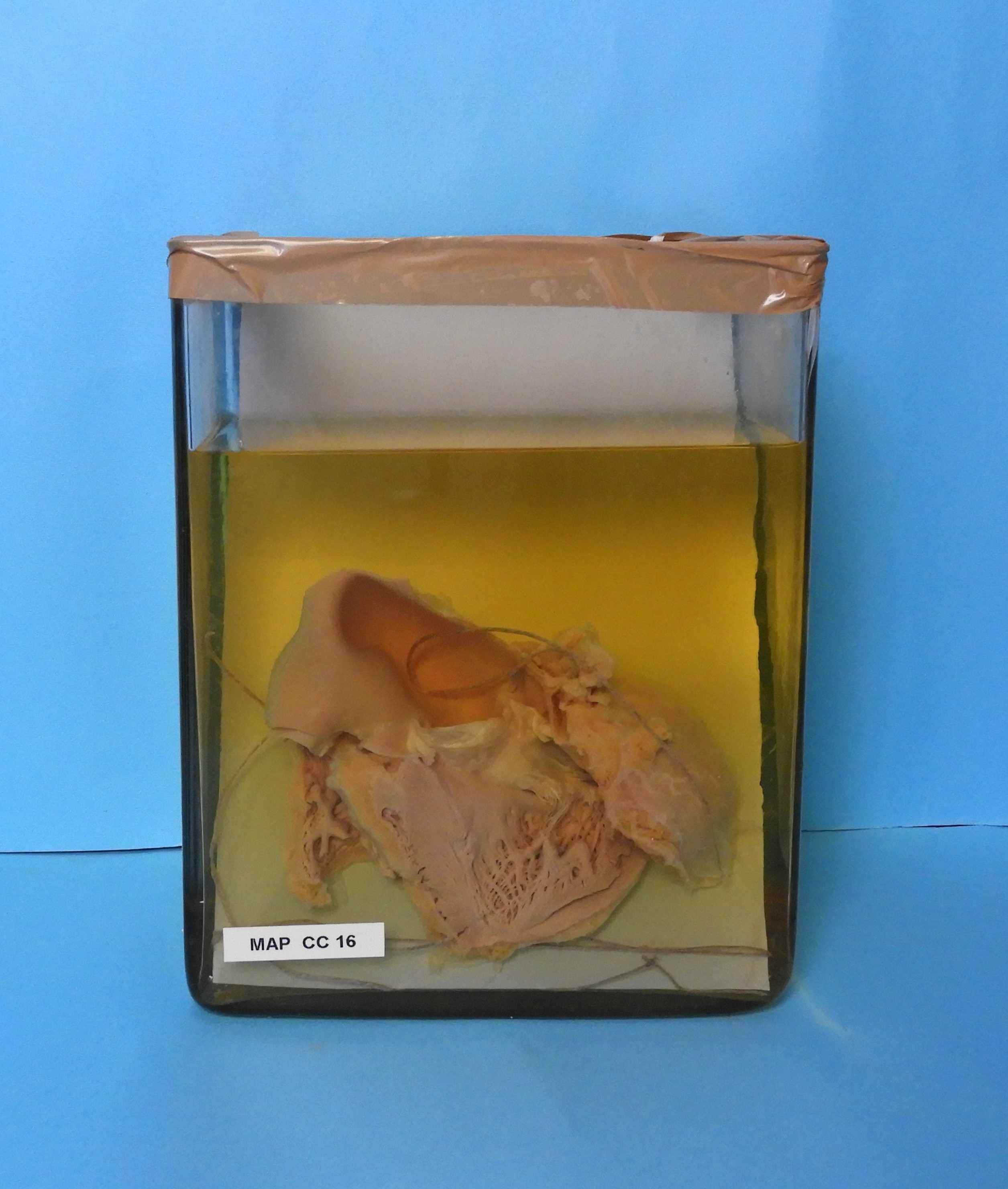 preparato anatomico, apparato cardiocircolatorio (morfologia naturale) (SECOLI/ XX)