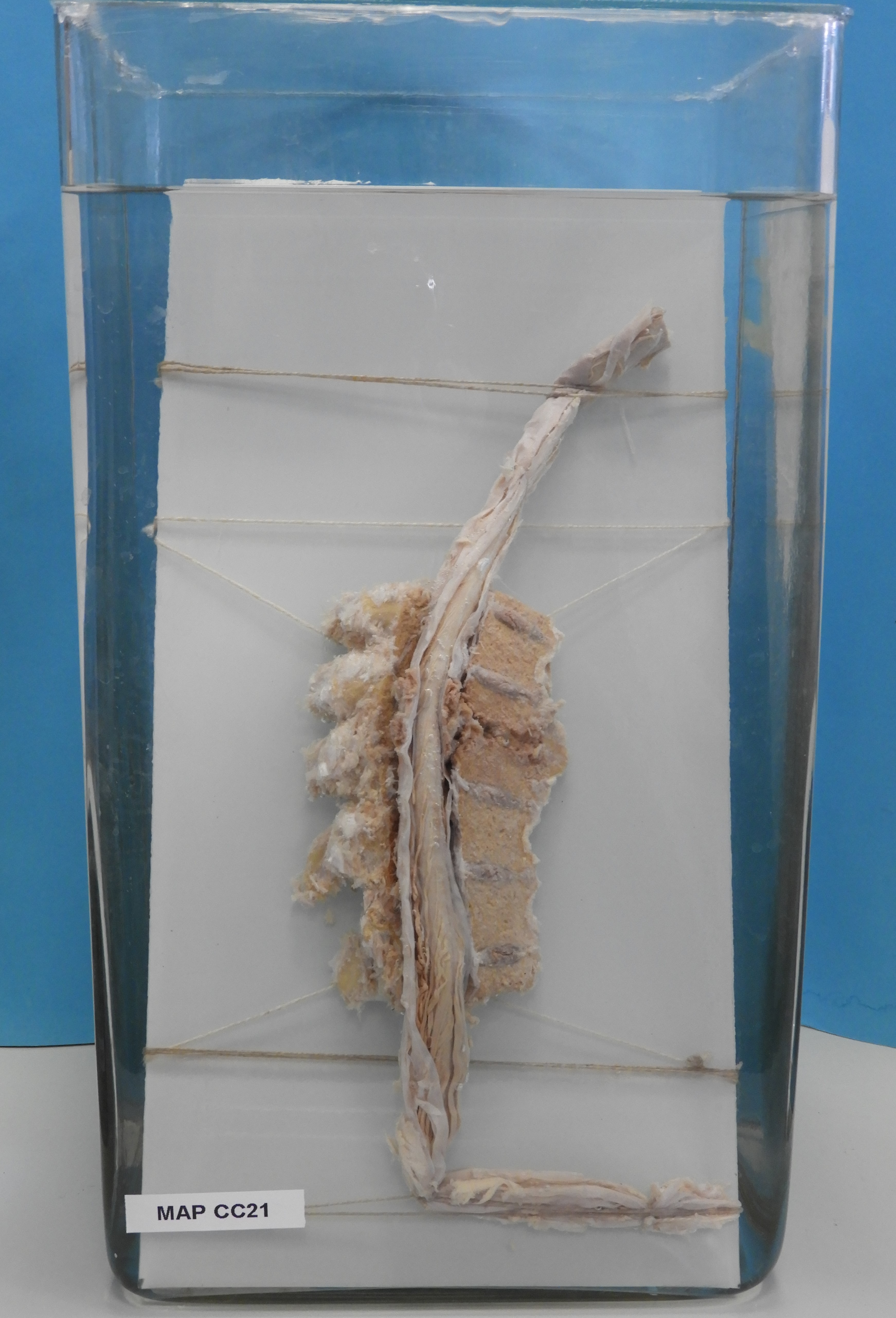 preparato anatomico, apparato cardiocircolatorio (morfologia naturale) (SECOLI/ XX)