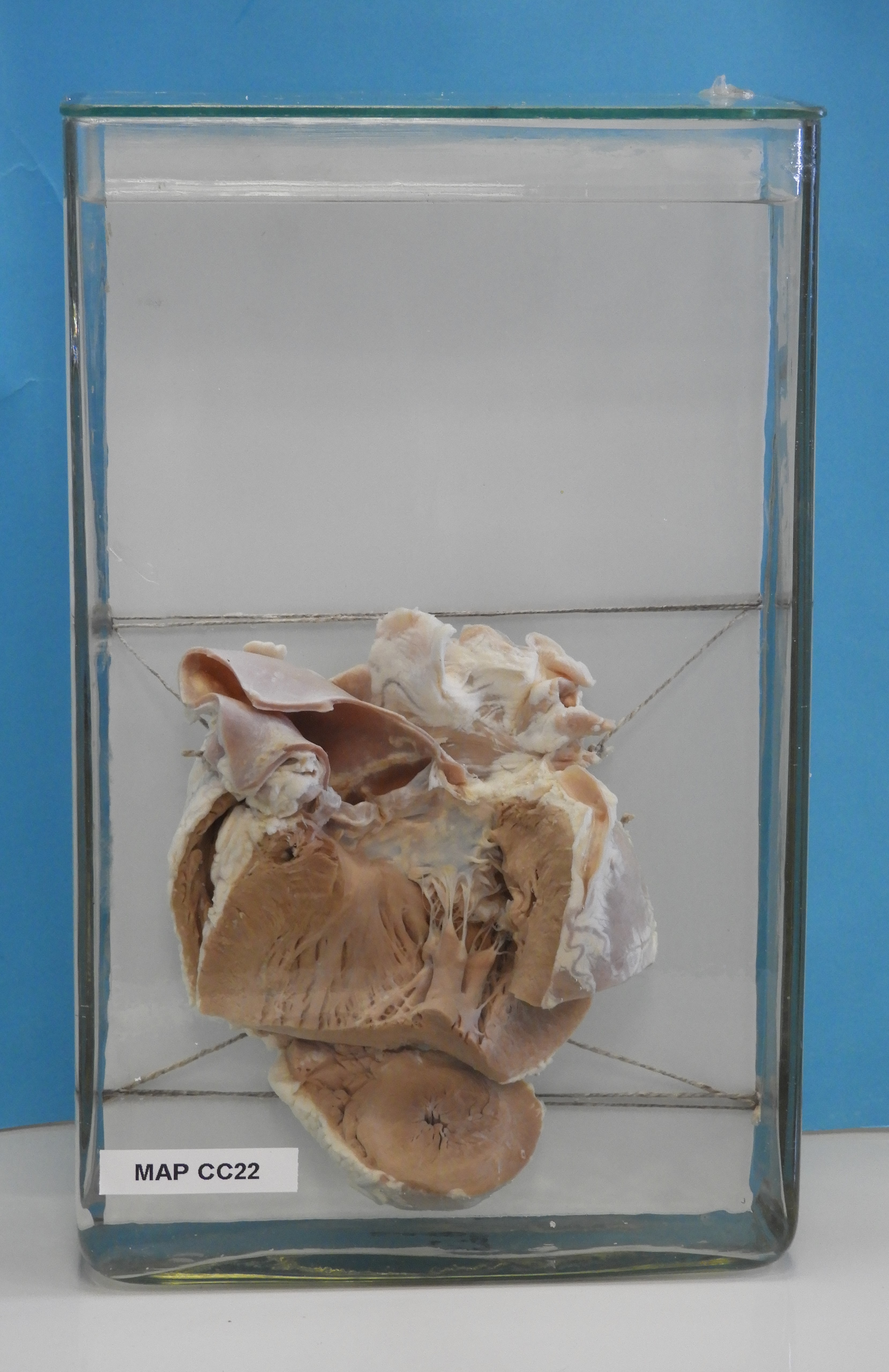 preparato anatomico, apparato cardiocircolatorio (morfologia naturale) (SECOLI/ XX)